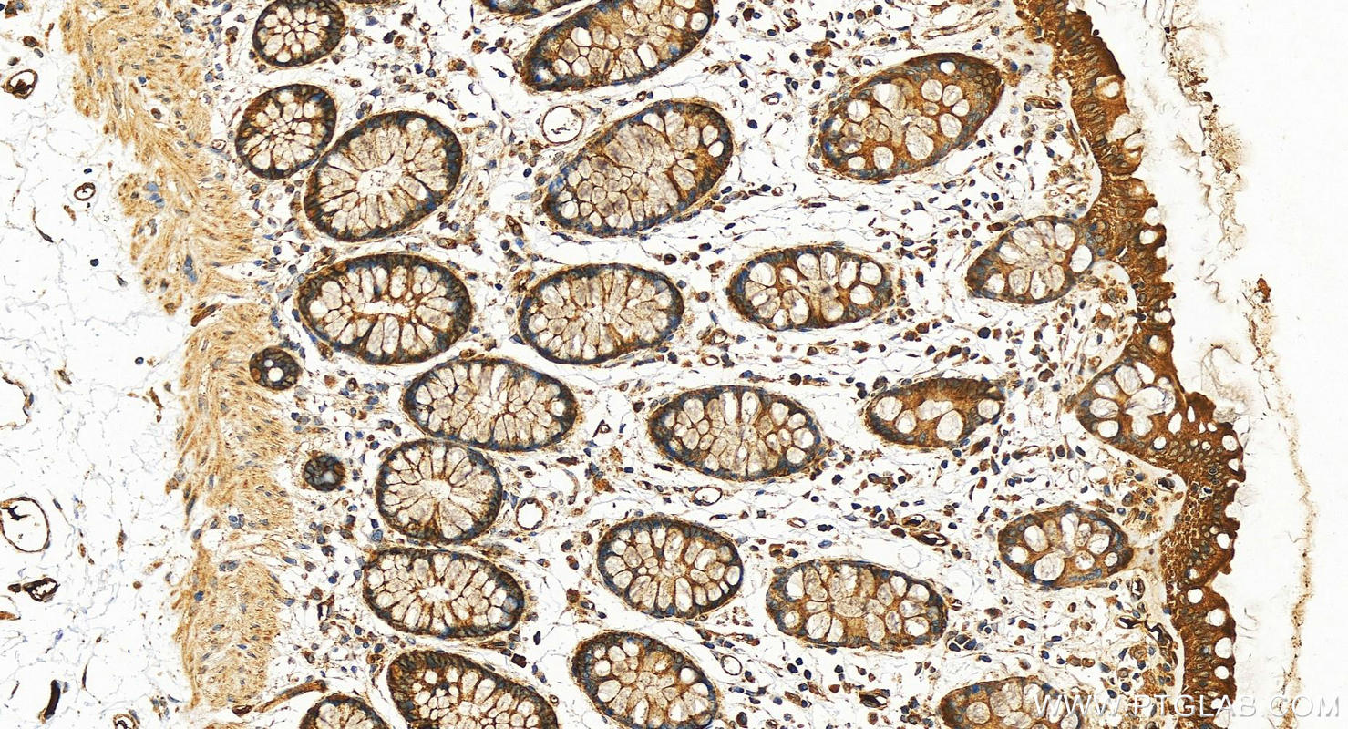 Immunohistochemistry (IHC) staining of human colon tissue using DAP3 Polyclonal antibody (10276-1-AP)