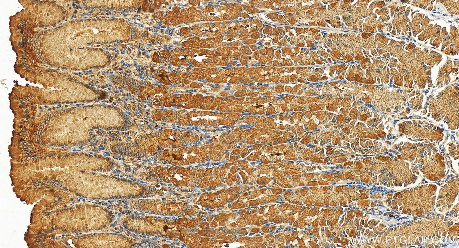 Immunohistochemistry (IHC) staining of human stomach tissue using DAP3 Polyclonal antibody (10276-1-AP)