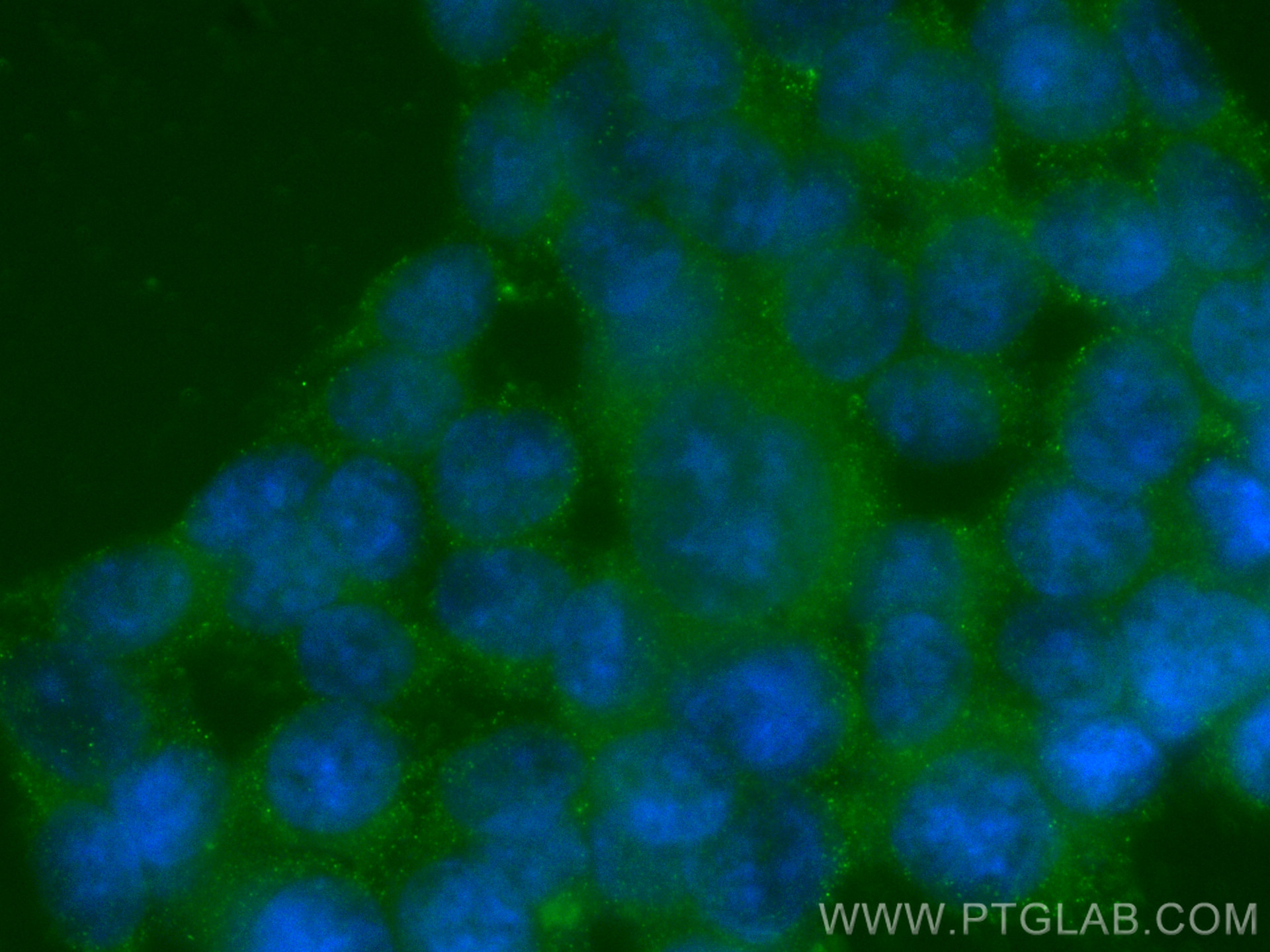 Immunofluorescence (IF) / fluorescent staining of HCT 116 cells using DAPK1 Monoclonal antibody (67815-1-Ig)