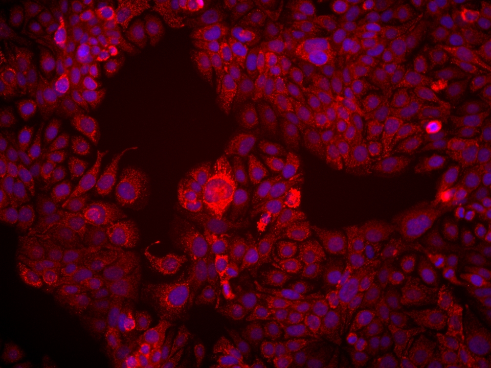 Immunofluorescence (IF) / fluorescent staining of HT-1376 cells using DAPK1 Monoclonal antibody (67815-1-Ig)