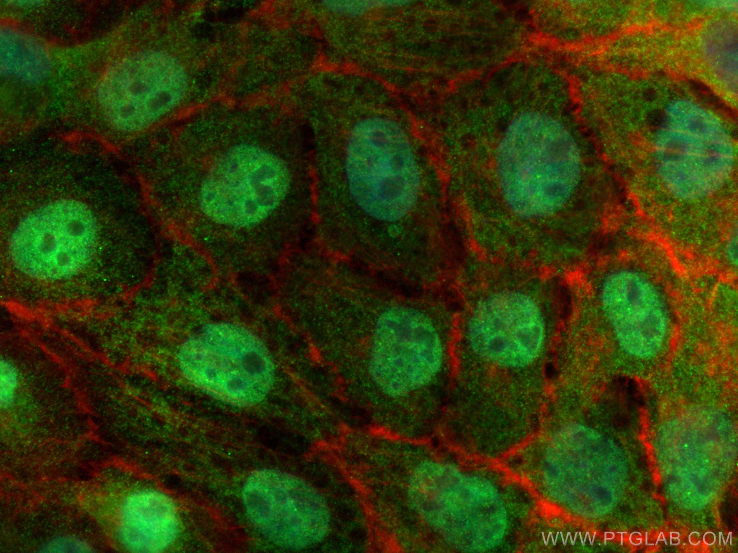 Immunofluorescence (IF) / fluorescent staining of A431 cells using DAPK3 Polyclonal antibody (30656-1-AP)