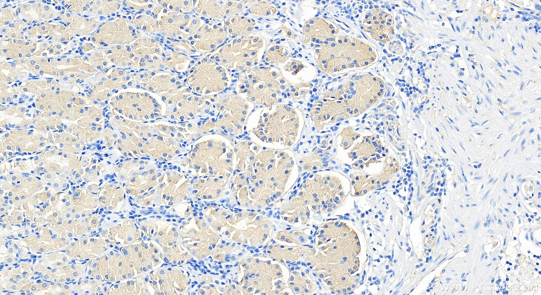 Immunohistochemistry (IHC) staining of human stomach tissue using DAZ4 Polyclonal antibody (14065-1-AP)