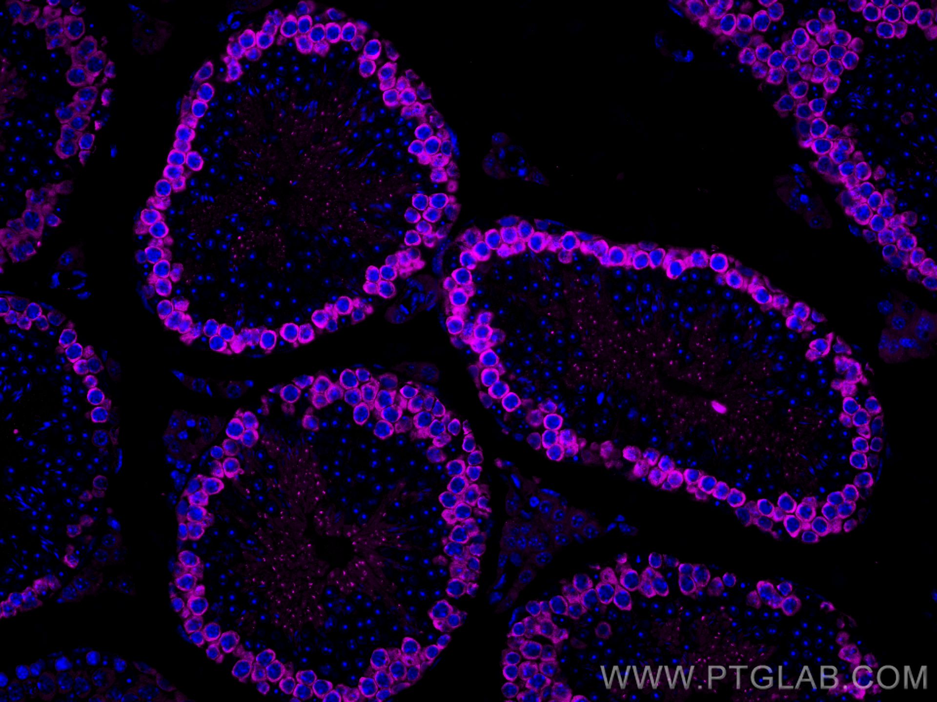 Immunofluorescence (IF) / fluorescent staining of mouse testis tissue using CoraLite® Plus 647-conjugated DAZL Polyclonal anti (CL647-12633)