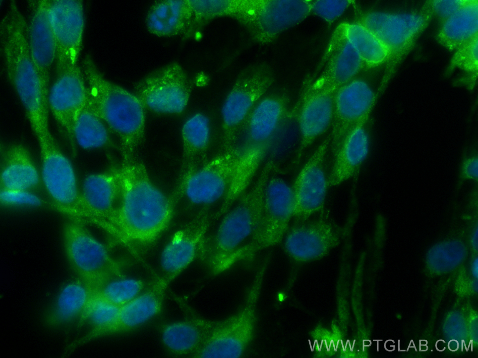 Immunofluorescence (IF) / fluorescent staining of SH-SY5Y cells using DBH Polyclonal antibody (10777-1-AP)