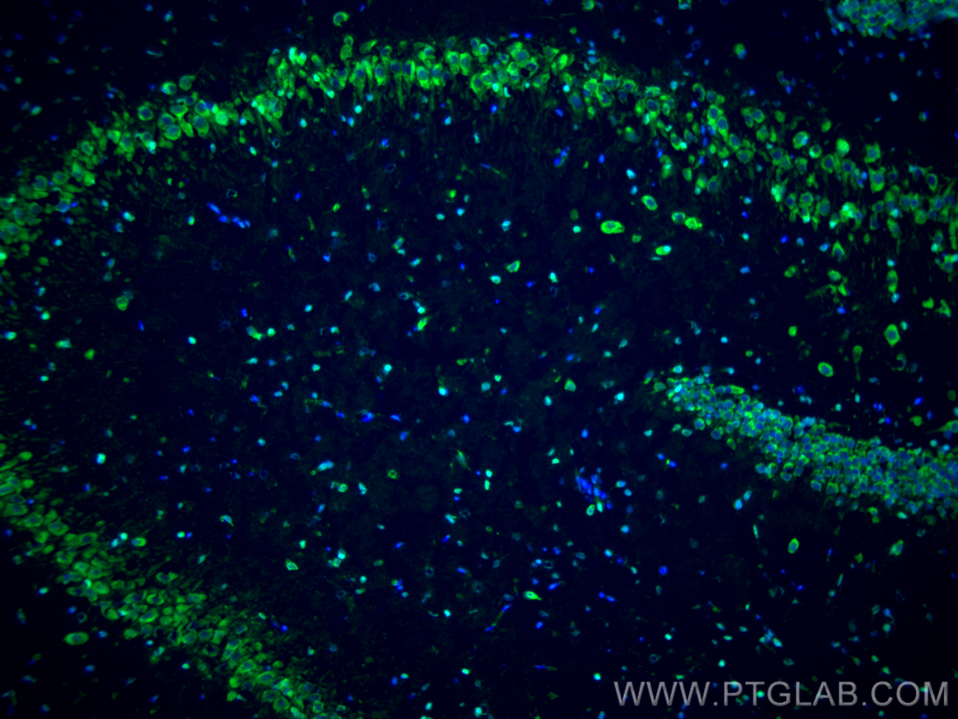 Immunofluorescence (IF) / fluorescent staining of rat brain tissue using DBH Polyclonal antibody (10777-1-AP)