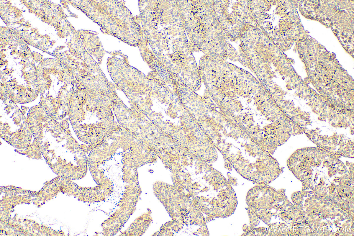 Immunohistochemistry (IHC) staining of mouse testis tissue using Drebrin Polyclonal antibody (10260-1-AP)