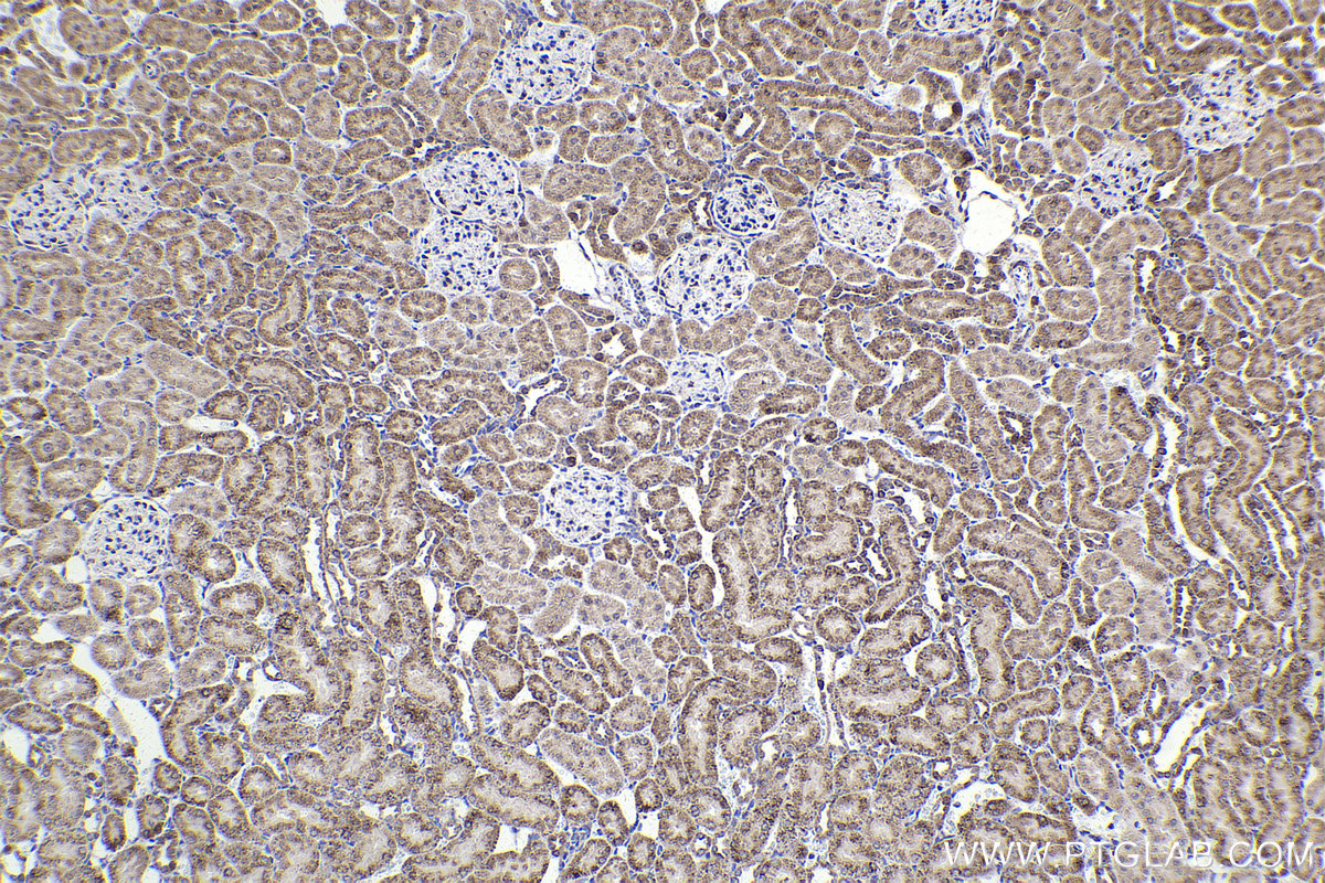 Immunohistochemistry (IHC) staining of rat kidney tissue using DBT Polyclonal antibody (12451-1-AP)