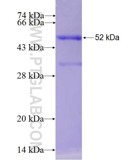 DCHS1 fusion protein Ag27226 SDS-PAGE