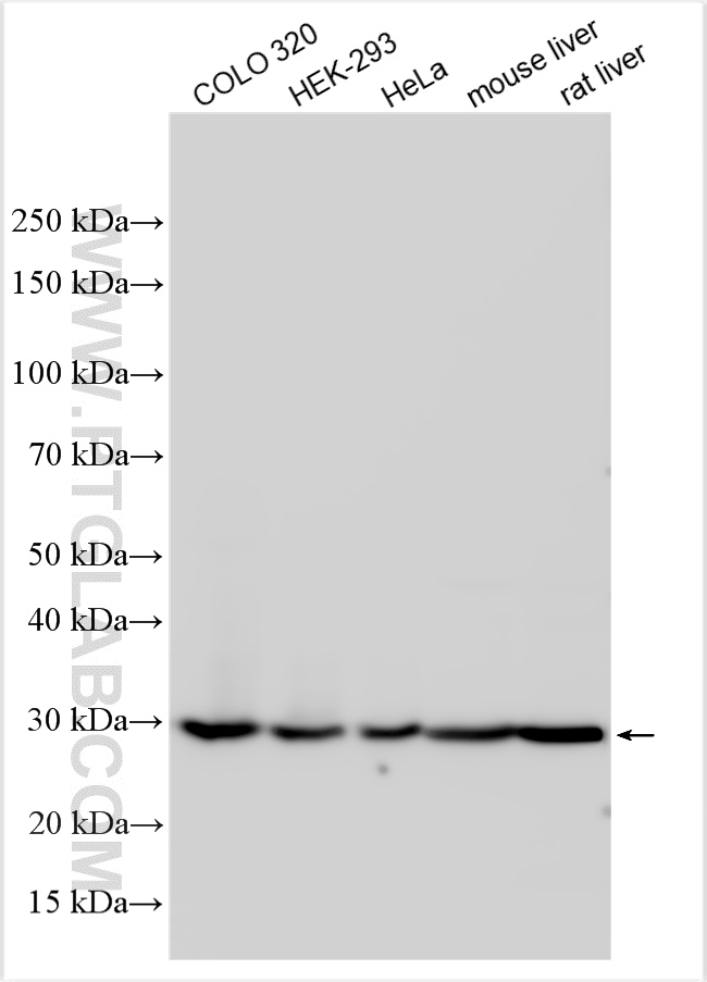 Western Blot (WB) analysis of various lysates using DCI Polyclonal antibody (11535-1-AP)