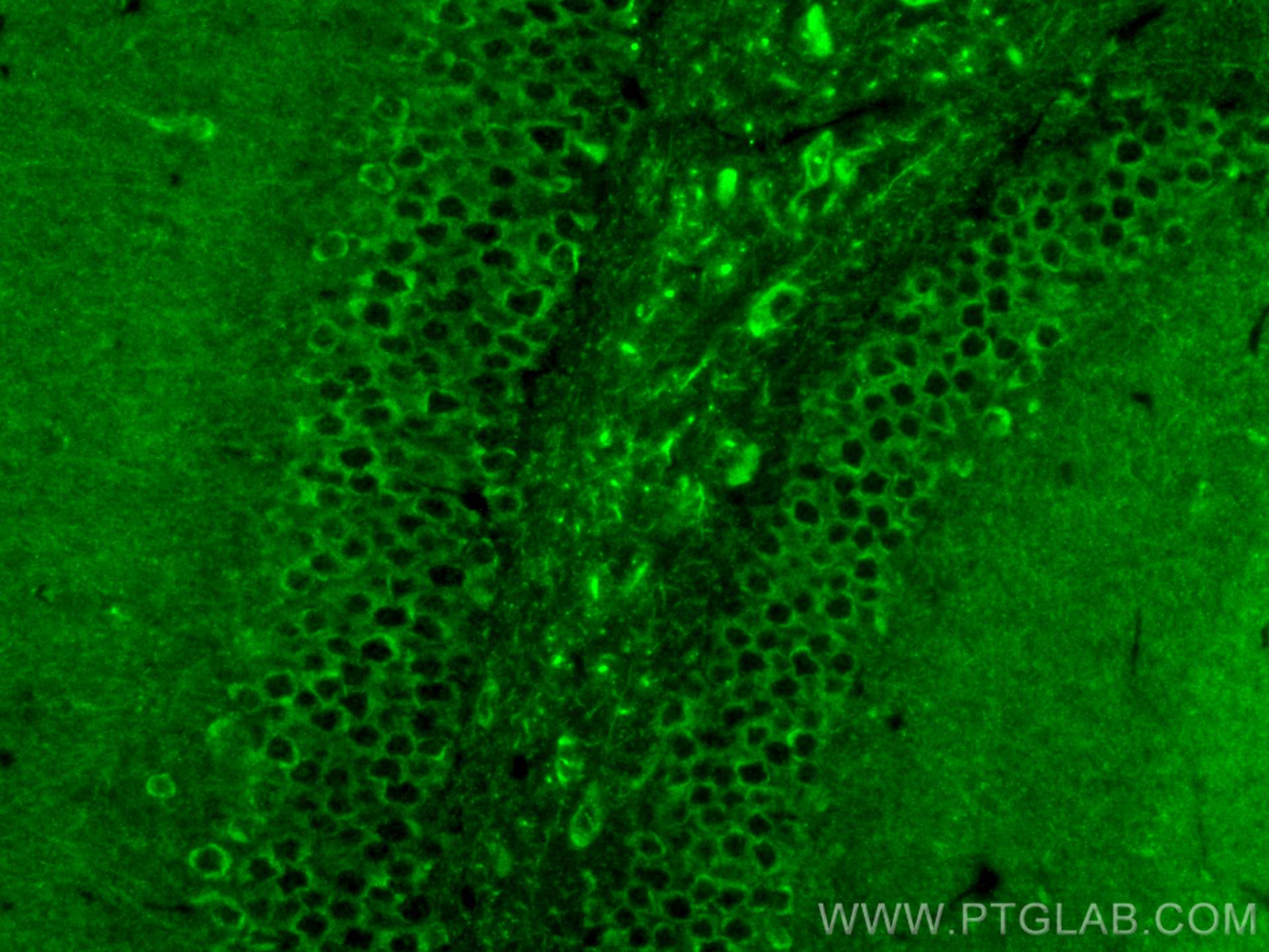 Immunofluorescence (IF) / fluorescent staining of mouse brain tissue using DCLK1 Polyclonal antibody (21699-1-AP)