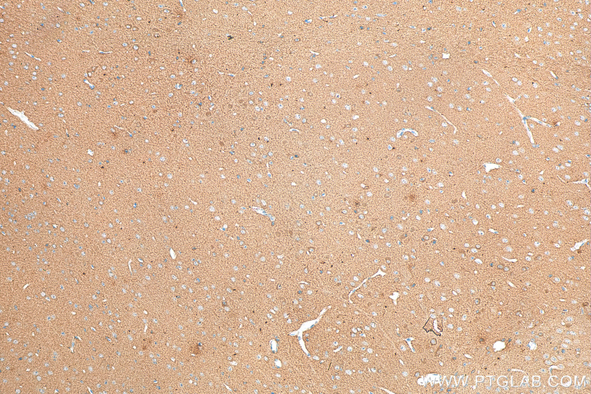 Immunohistochemistry (IHC) staining of mouse brain tissue using DCLK1 Monoclonal antibody (68234-1-Ig)