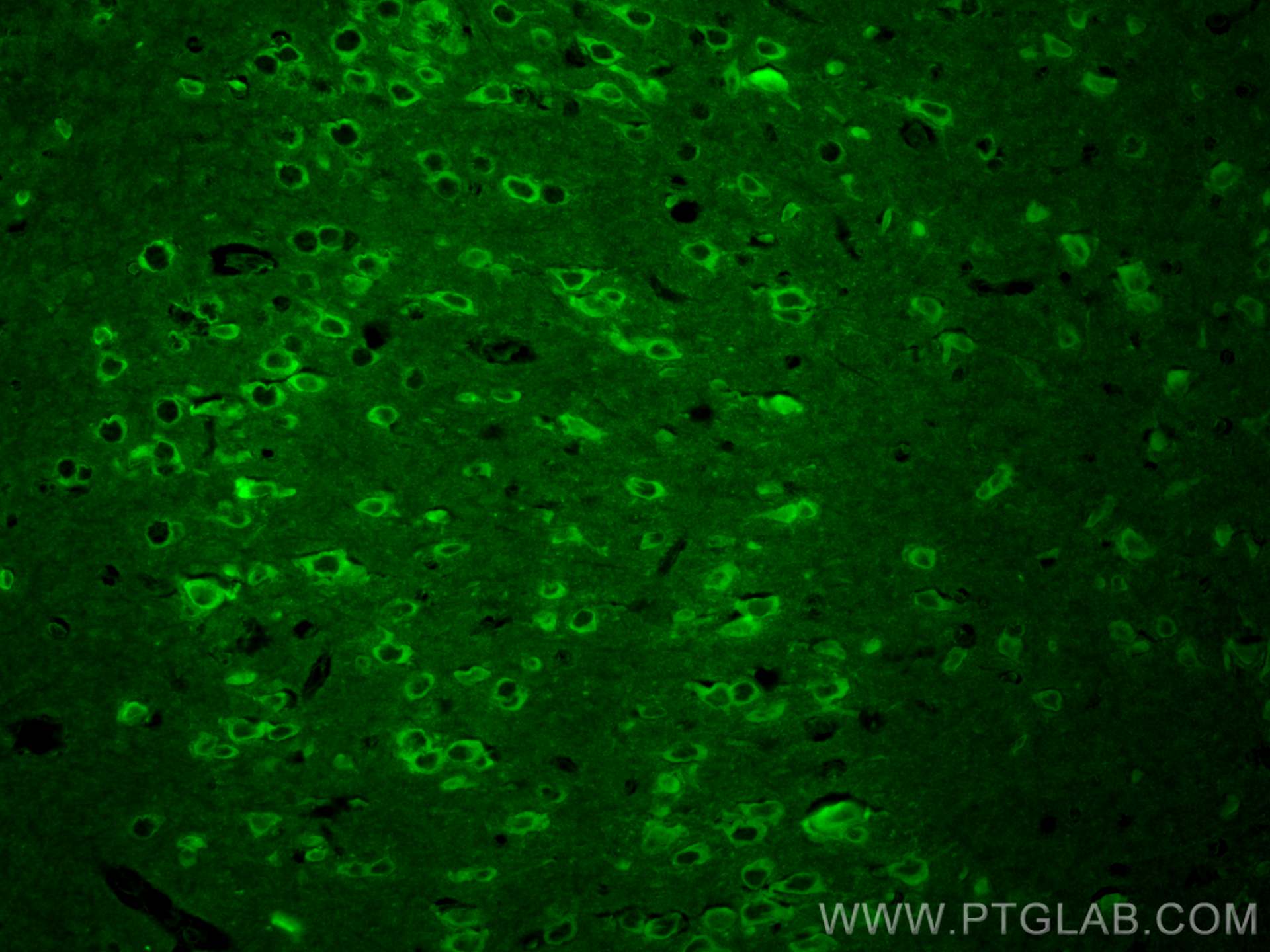 Immunofluorescence (IF) / fluorescent staining of mouse brain tissue using CoraLite® Plus 488-conjugated DCLK1 Polyclonal ant (CL488-29800)