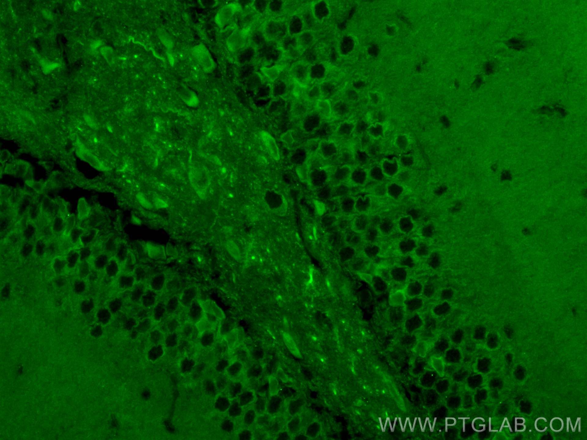 Immunofluorescence (IF) / fluorescent staining of mouse brain tissue using CoraLite® Plus 488-conjugated DCLK1 Polyclonal ant (CL488-29800)