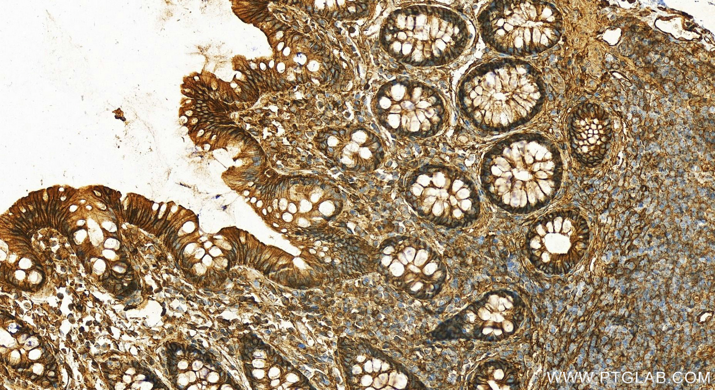 Immunohistochemistry (IHC) staining of human normal colon using Decorin Polyclonal antibody (14667-1-AP)