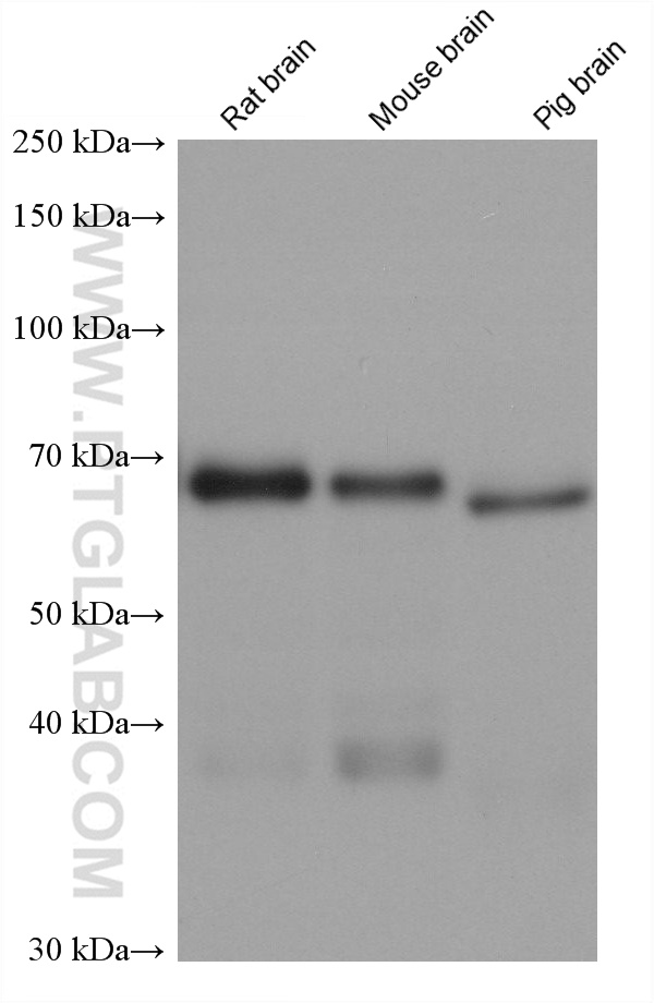 Western Blot (WB) analysis of various lysates using DCP1A Monoclonal antibody (60494-1-Ig)