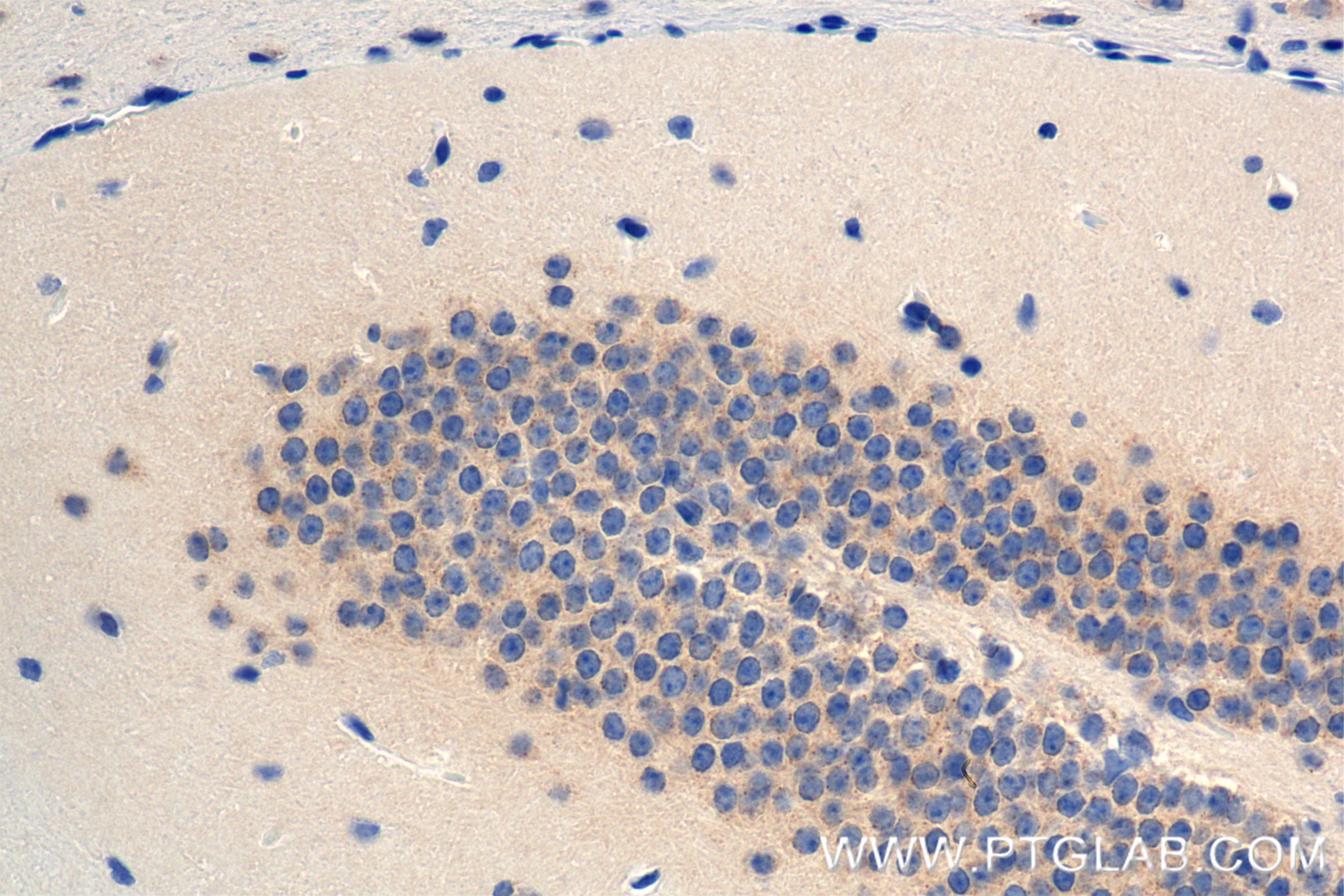 Immunohistochemistry (IHC) staining of mouse brain tissue using DCP1A Recombinant antibody (85047-5-RR)