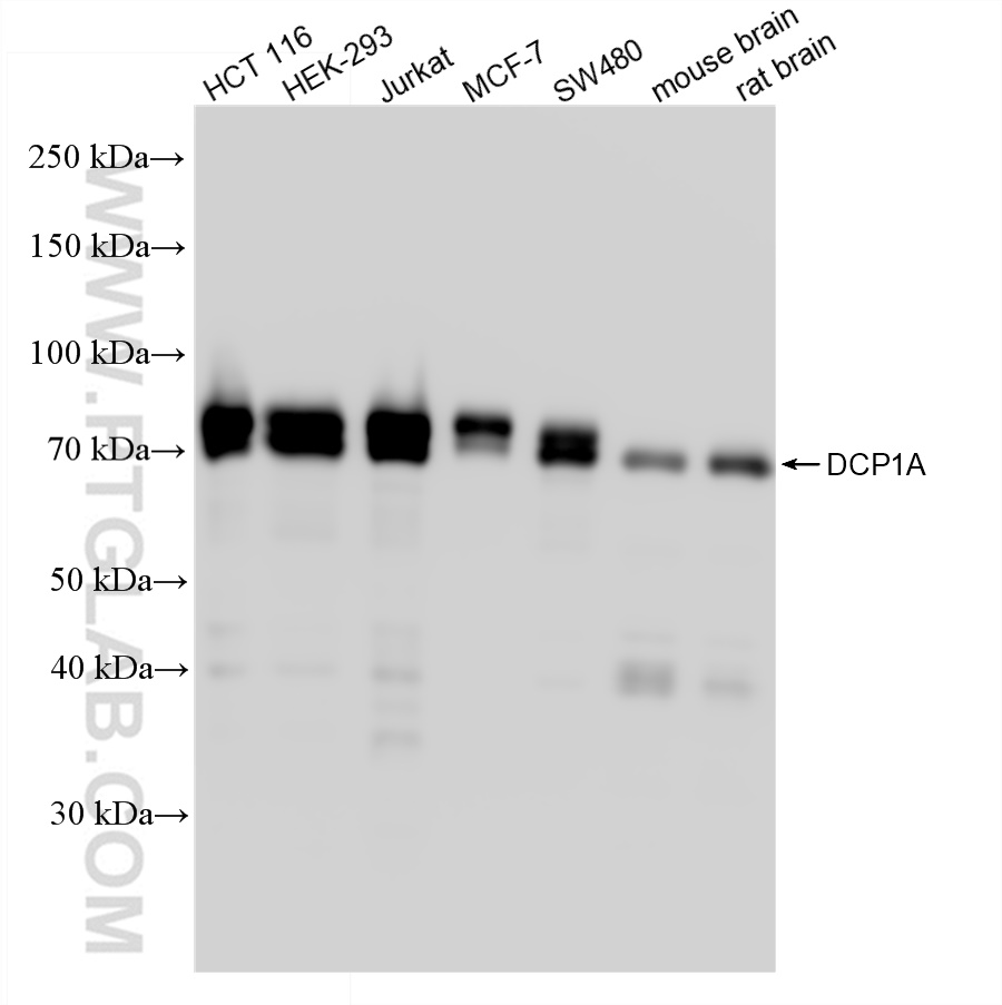 Western Blot (WB) analysis of various lysates using DCP1A Recombinant antibody (85047-5-RR)