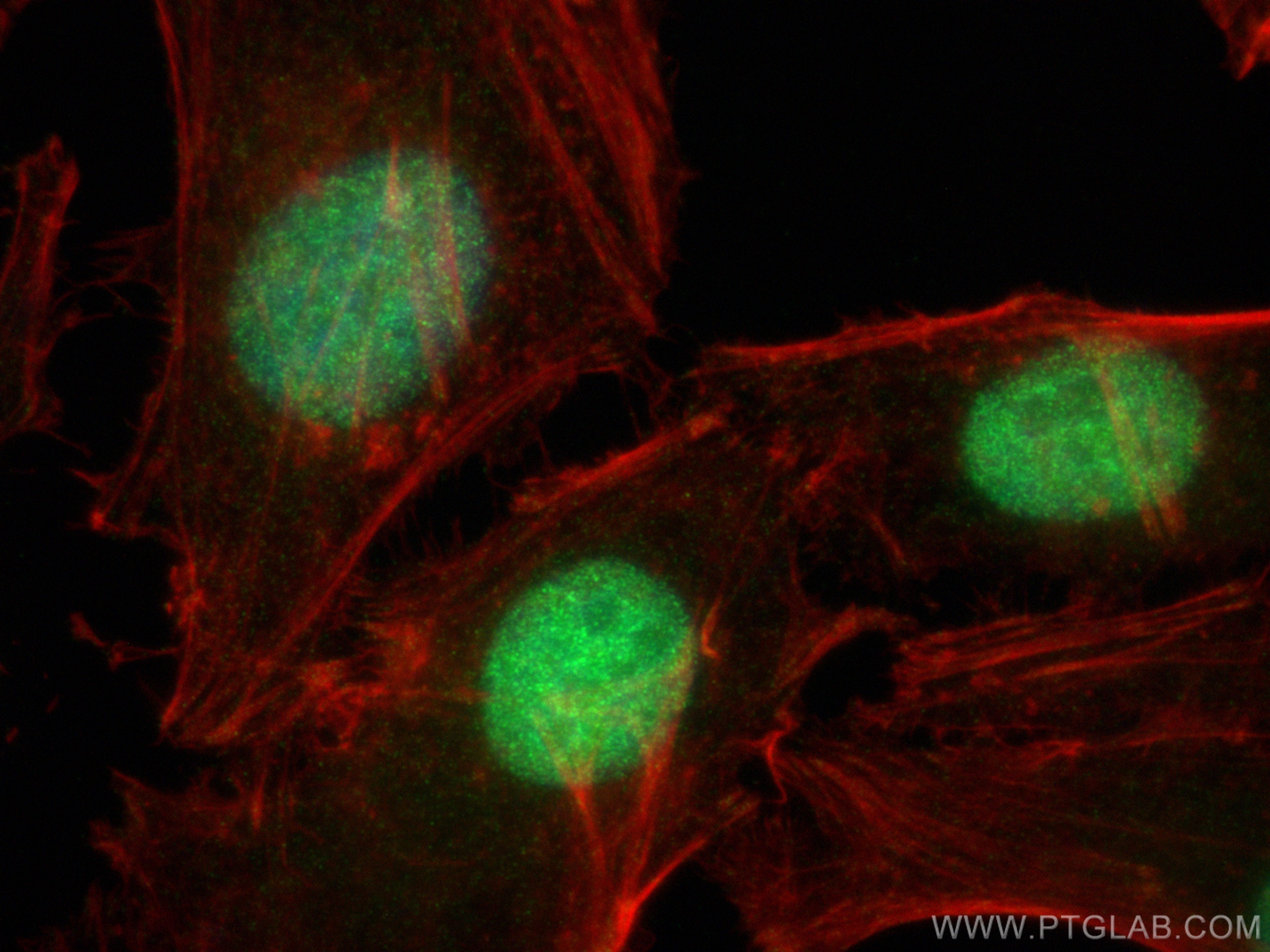 Immunofluorescence (IF) / fluorescent staining of HeLa cells using DCPS Polyclonal antibody (28465-1-AP)