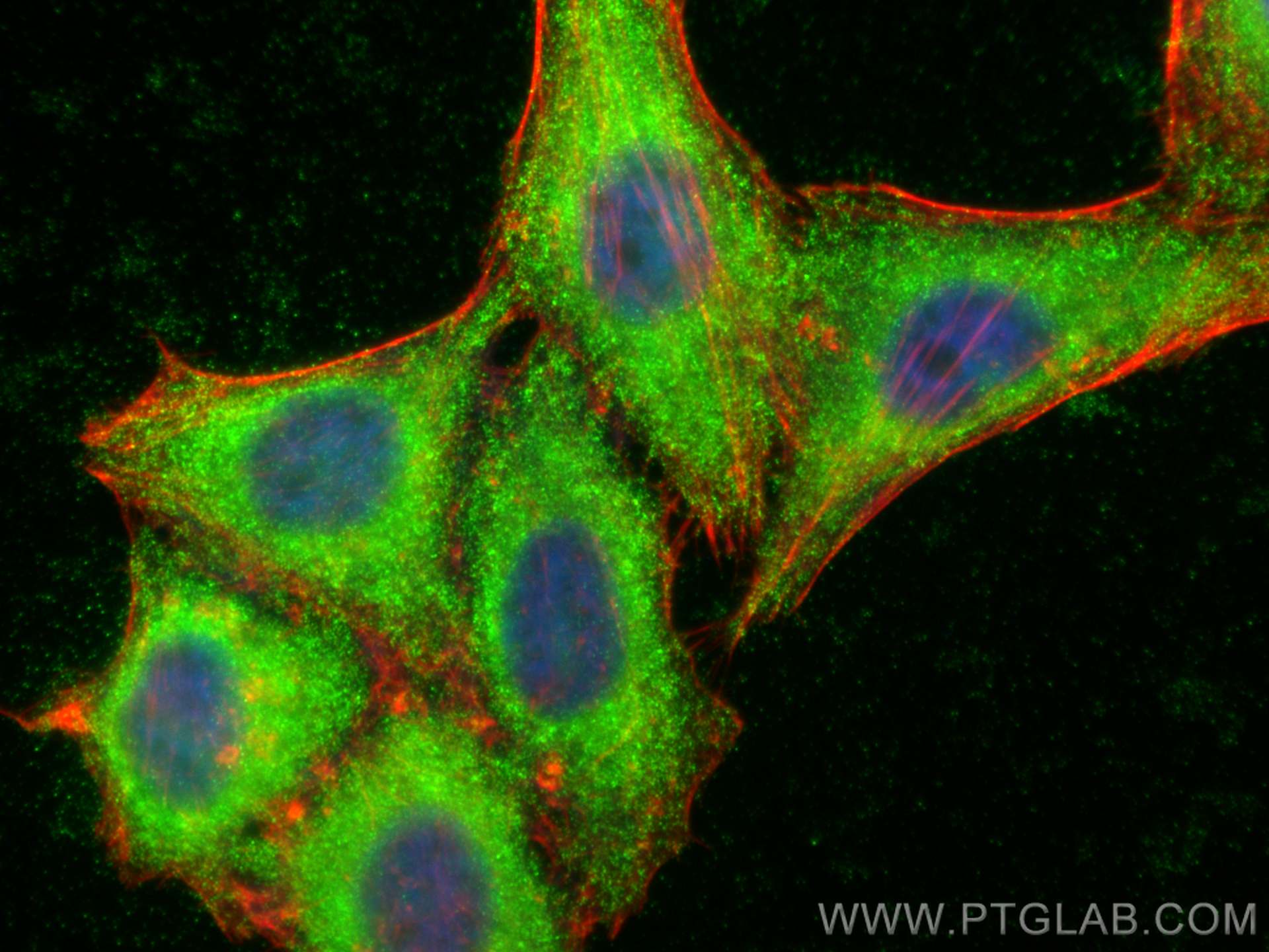 Immunofluorescence (IF) / fluorescent staining of HepG2 cells using DCTD Polyclonal antibody (16784-1-AP)