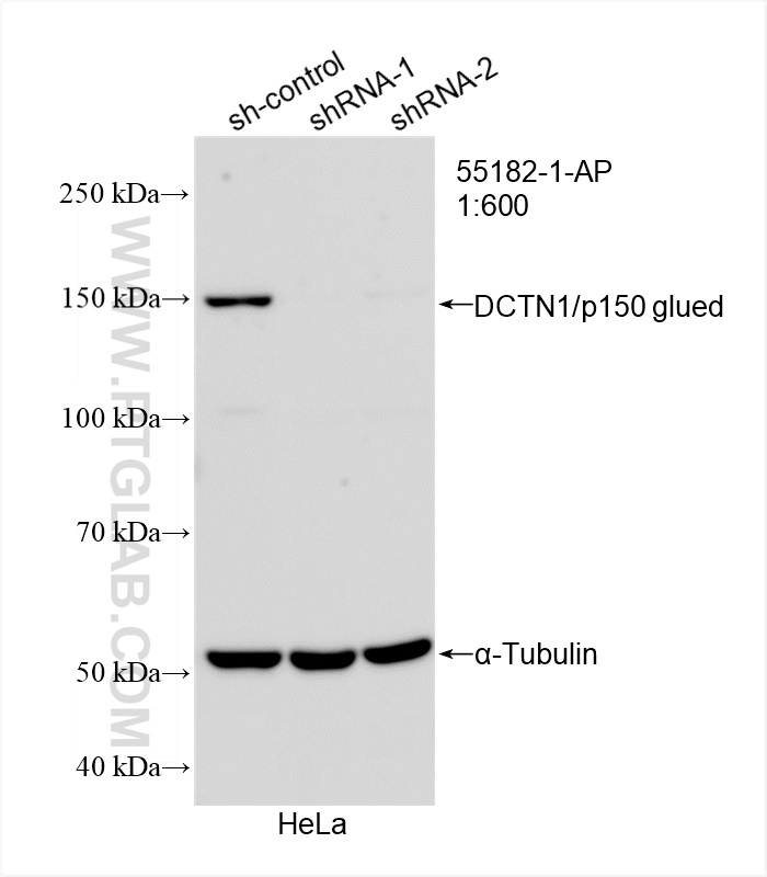 Western Blot (WB) analysis of HeLa cells using DCTN1/p150 glued Polyclonal antibody (55182-1-AP)