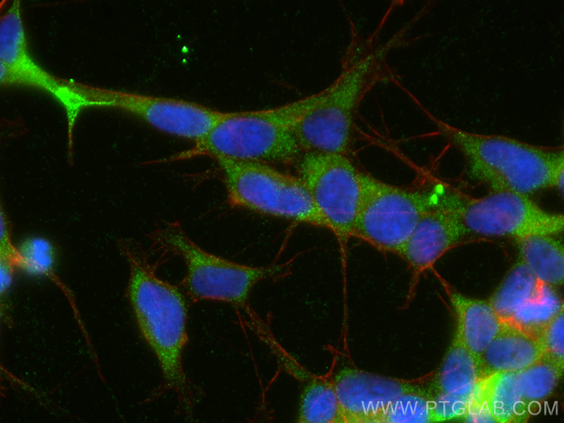 Immunofluorescence (IF) / fluorescent staining of SH-SY5Y cells using DCX Polyclonal antibody (13925-1-AP)