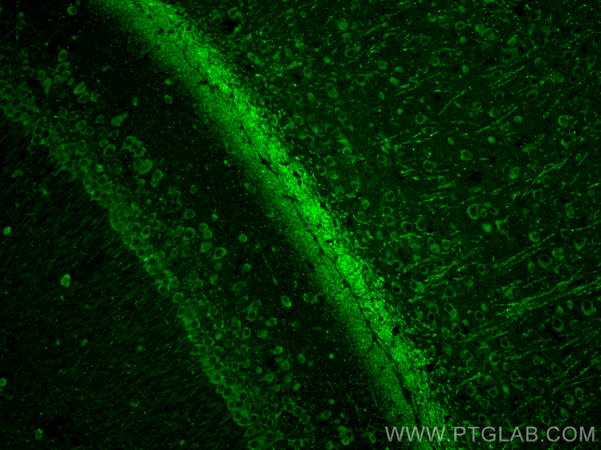 Immunofluorescence (IF) / fluorescent staining of mouse brain tissue using DCX Polyclonal antibody (13925-1-AP)