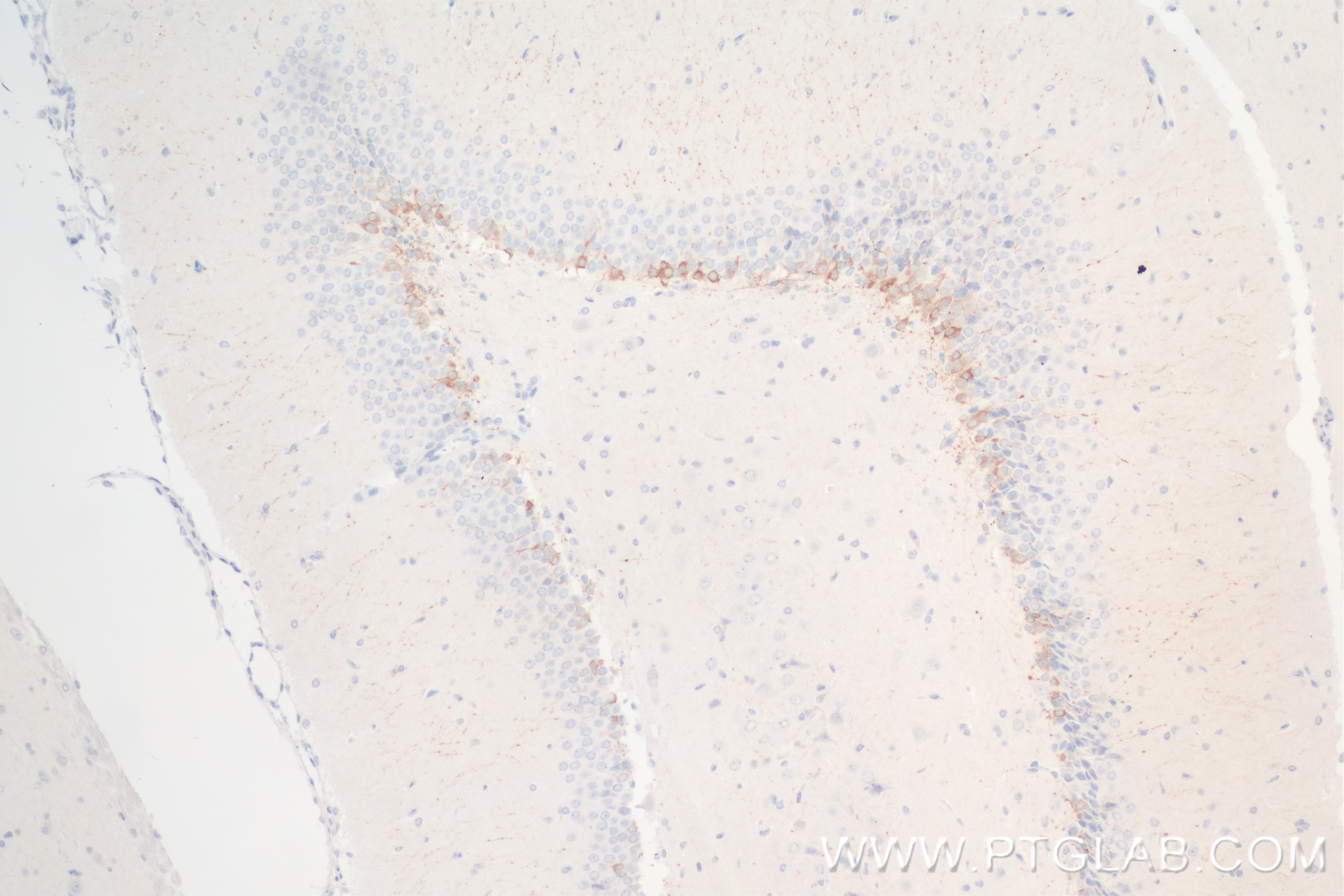 Immunohistochemistry (IHC) staining of rat brain tissue using DCX Recombinant antibody (84595-4-RR)