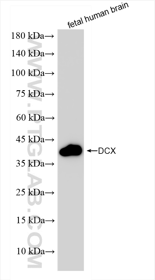 Western Blot (WB) analysis of fetal human brain tissue using DCX Recombinant antibody (84595-4-RR)