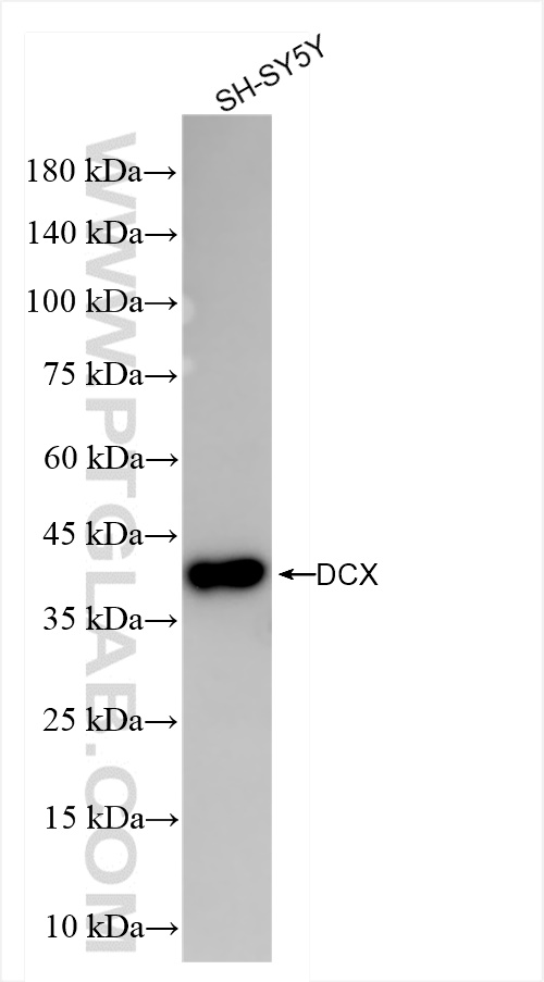 Western Blot (WB) analysis of SH-SY5Y cells using DCX Recombinant antibody (84595-4-RR)