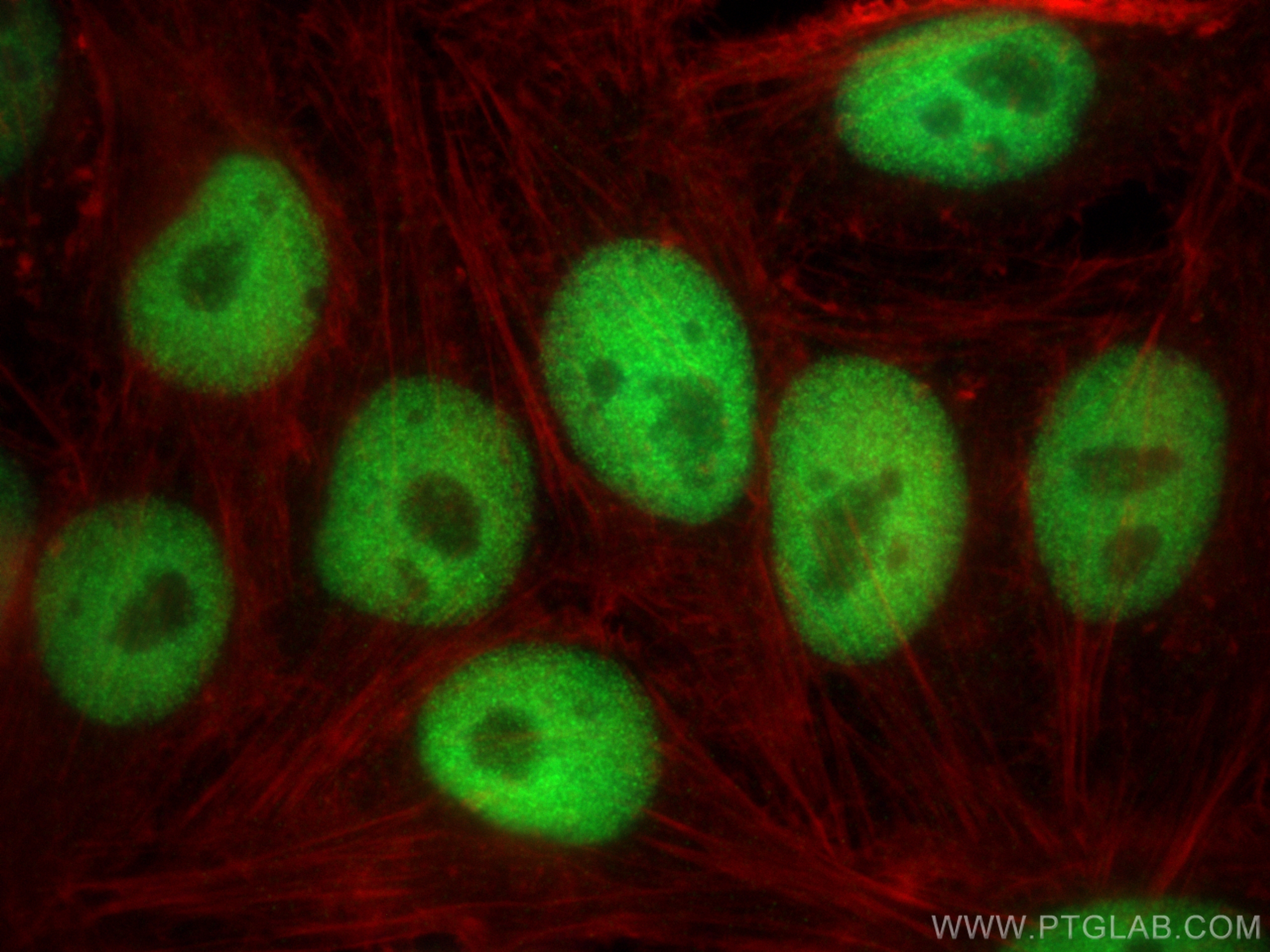 Immunofluorescence (IF) / fluorescent staining of HepG2 cells using DDA1 Polyclonal antibody (14995-1-AP)