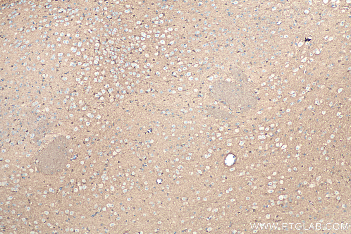 Immunohistochemistry (IHC) staining of mouse brain tissue using DDAH1 Polyclonal antibody (30108-1-AP)