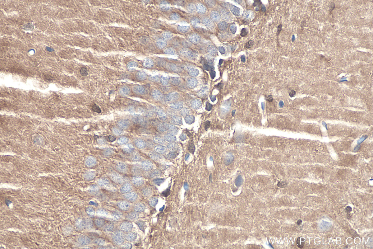 Immunohistochemistry (IHC) staining of rat brain tissue using DDAH1 Polyclonal antibody (30108-1-AP)