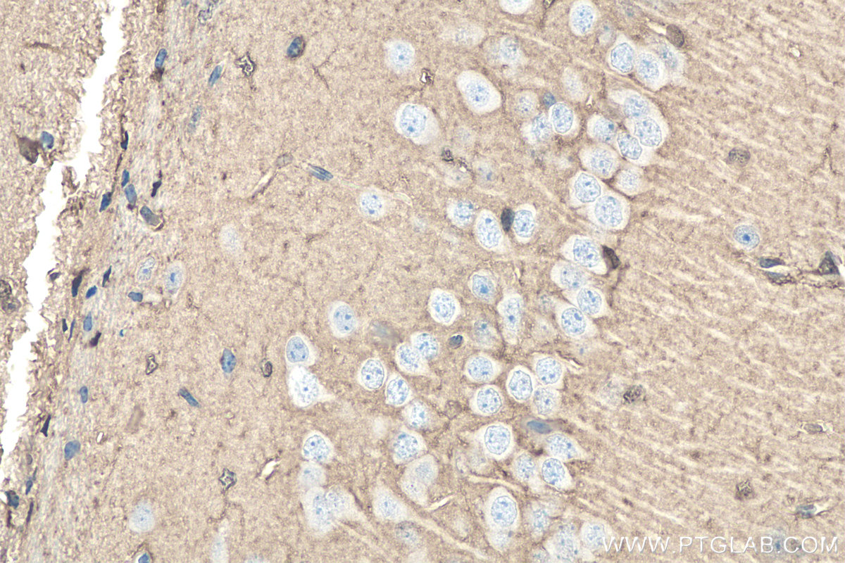 Immunohistochemistry (IHC) staining of mouse brain tissue using DDAH1 Polyclonal antibody (30108-1-AP)