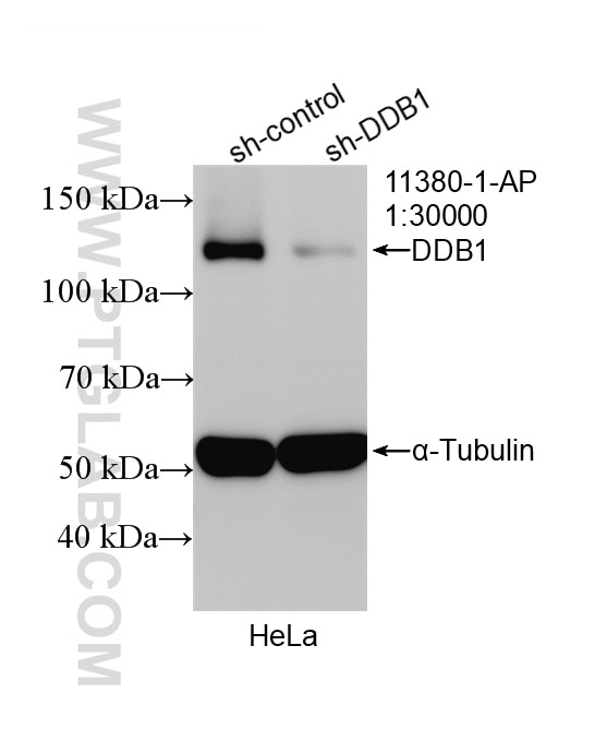 Western Blot (WB) analysis of HeLa cells using DDB1 Polyclonal antibody (11380-1-AP)