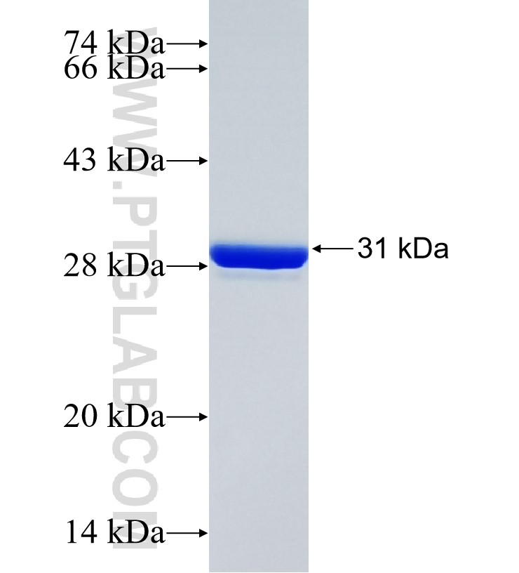 DDI2 fusion protein Ag22279 SDS-PAGE