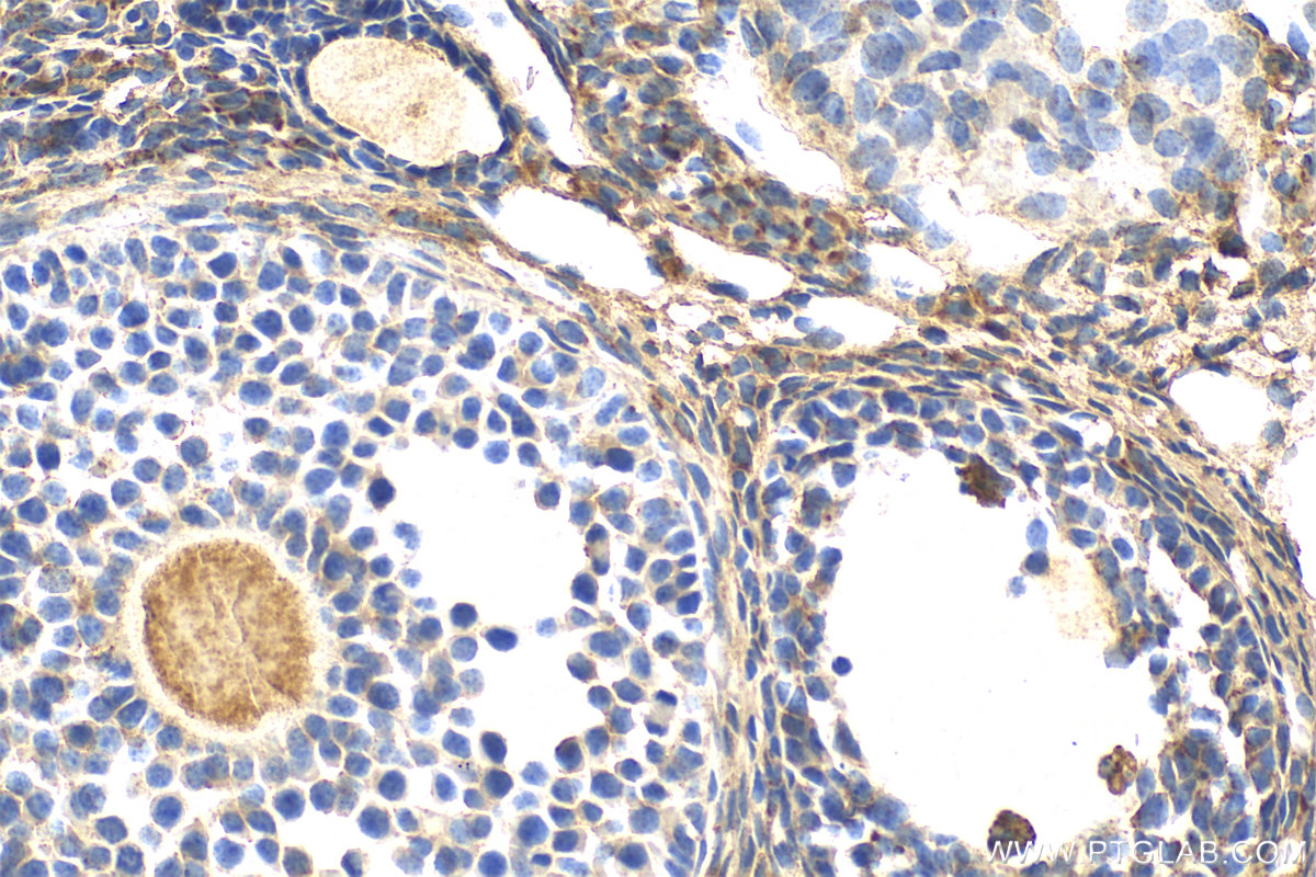 Immunohistochemistry (IHC) staining of mouse ovary tissue using DDIT4L Polyclonal antibody (28490-1-AP)