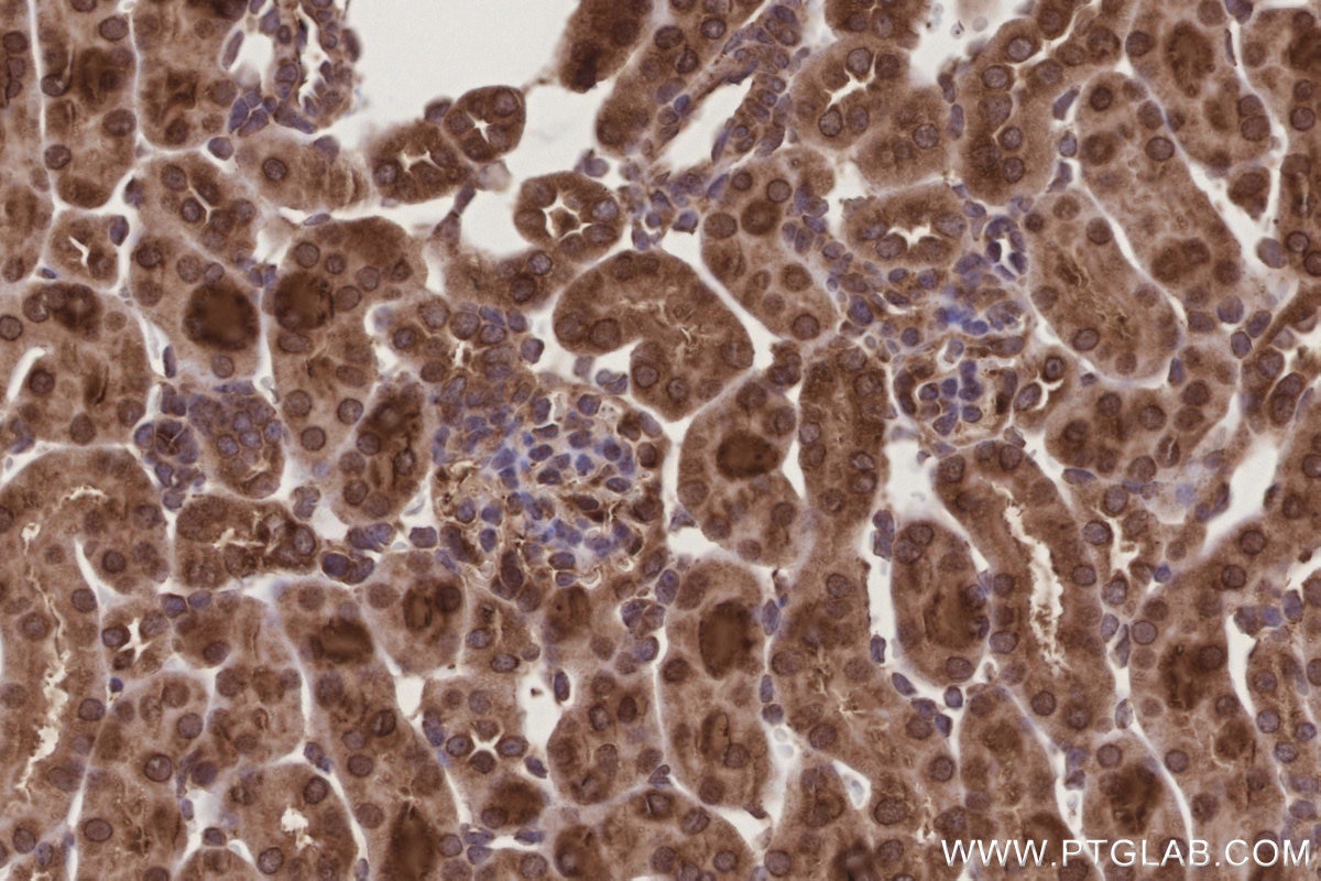 Immunohistochemistry (IHC) staining of mouse kidney tissue using DDOST Polyclonal antibody (14916-1-AP)