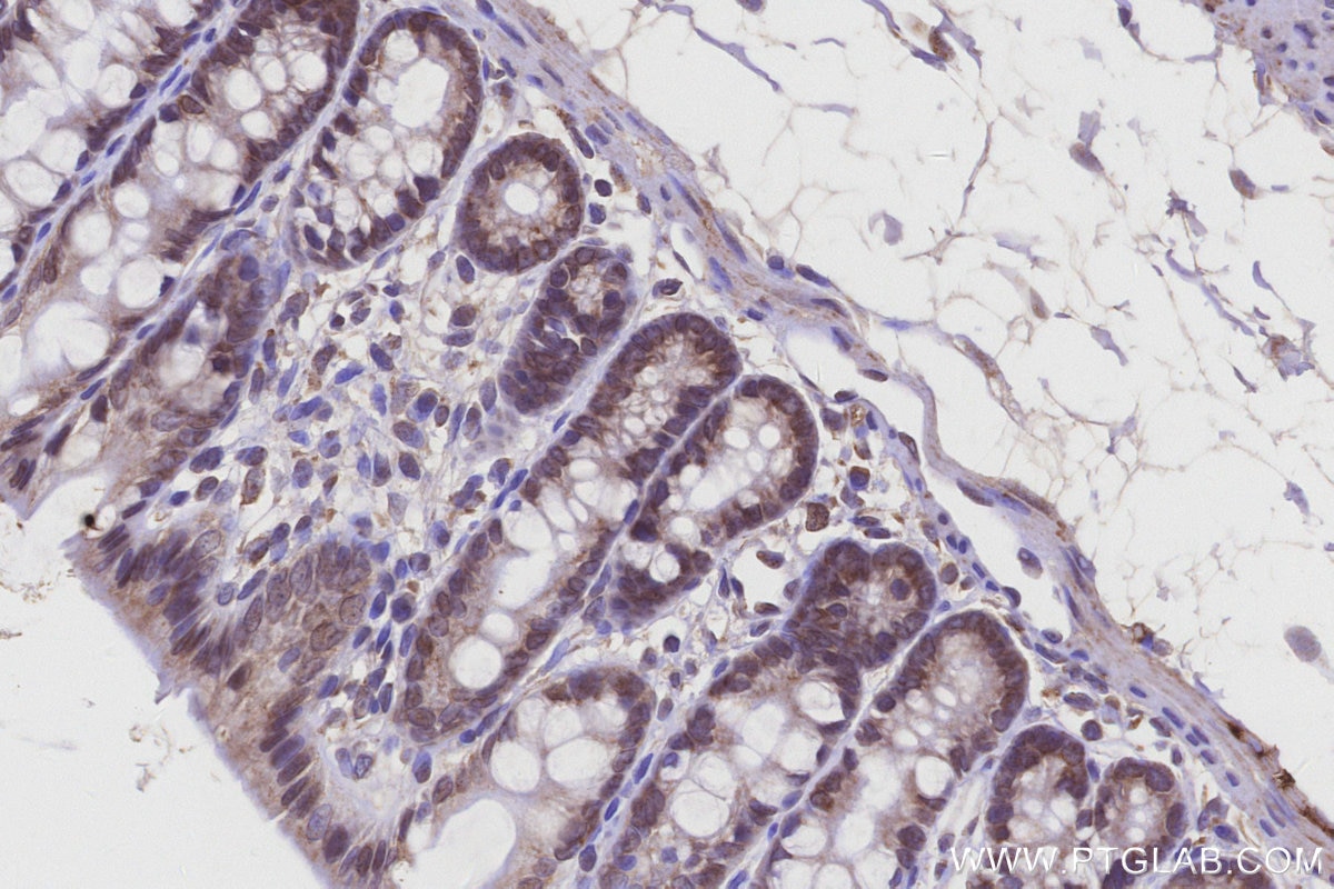 Immunohistochemistry (IHC) staining of rat colon tissue using DDOST Polyclonal antibody (14916-1-AP)