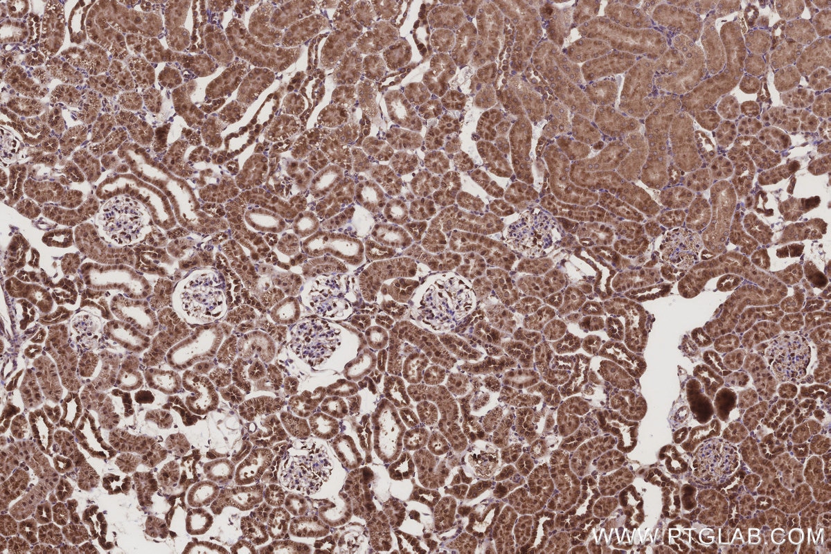 Immunohistochemistry (IHC) staining of rat kidney tissue using DDOST Polyclonal antibody (14916-1-AP)