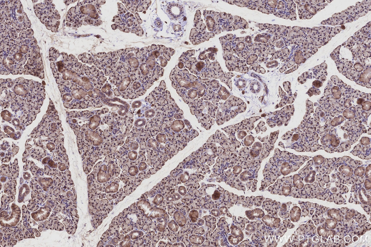 Immunohistochemistry (IHC) staining of rat salivary gland tissue using DDOST Polyclonal antibody (14916-1-AP)