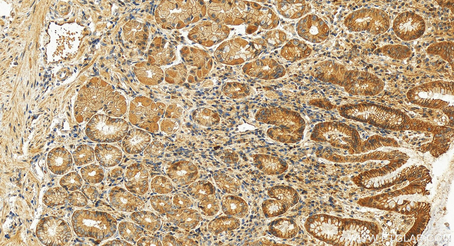 Immunohistochemistry (IHC) staining of human stomach tissue using DDR1 Polyclonal antibody (10536-1-AP)