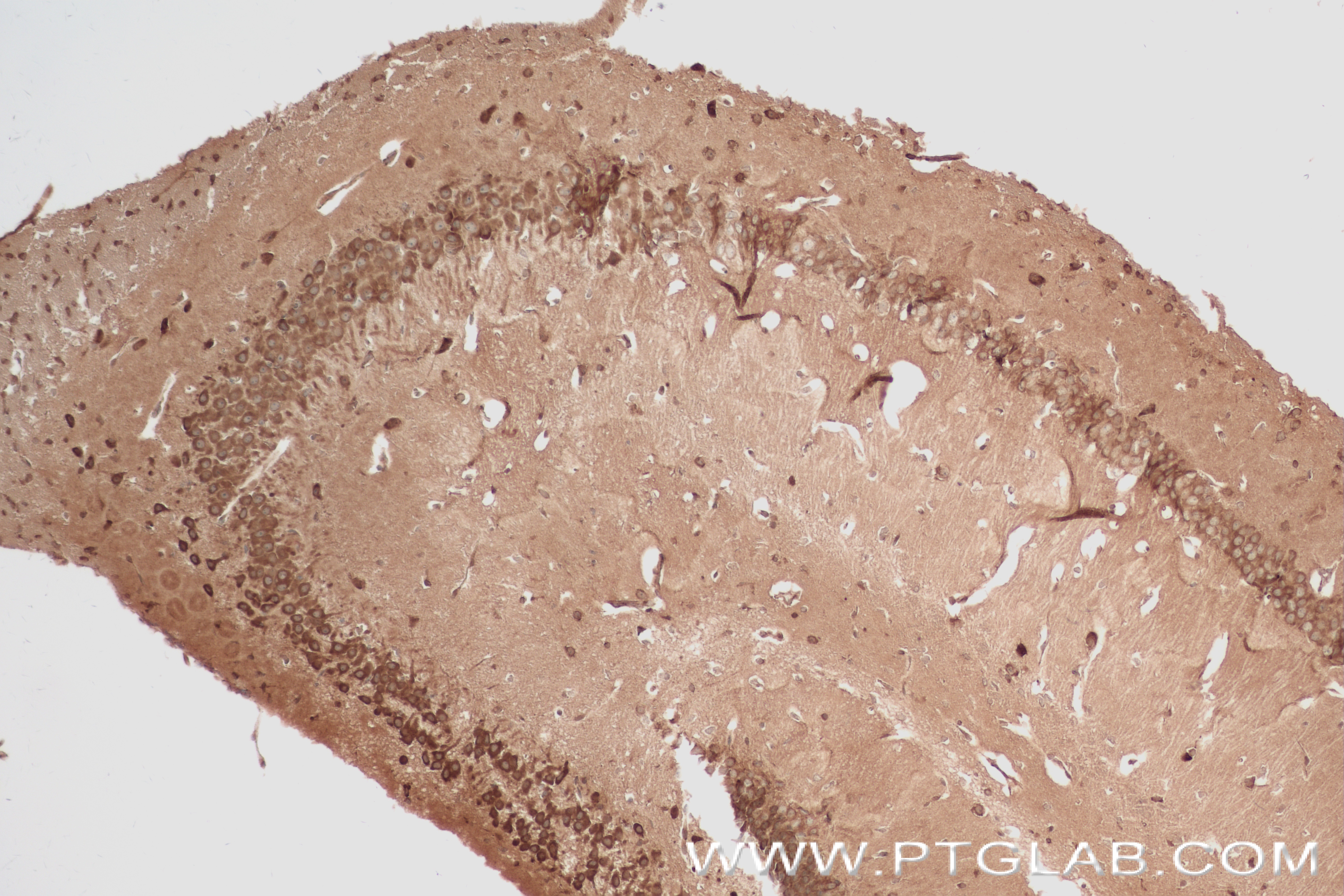 Immunohistochemistry (IHC) staining of mouse brain tissue using DDR1 Recombinant antibody (84438-6-RR)