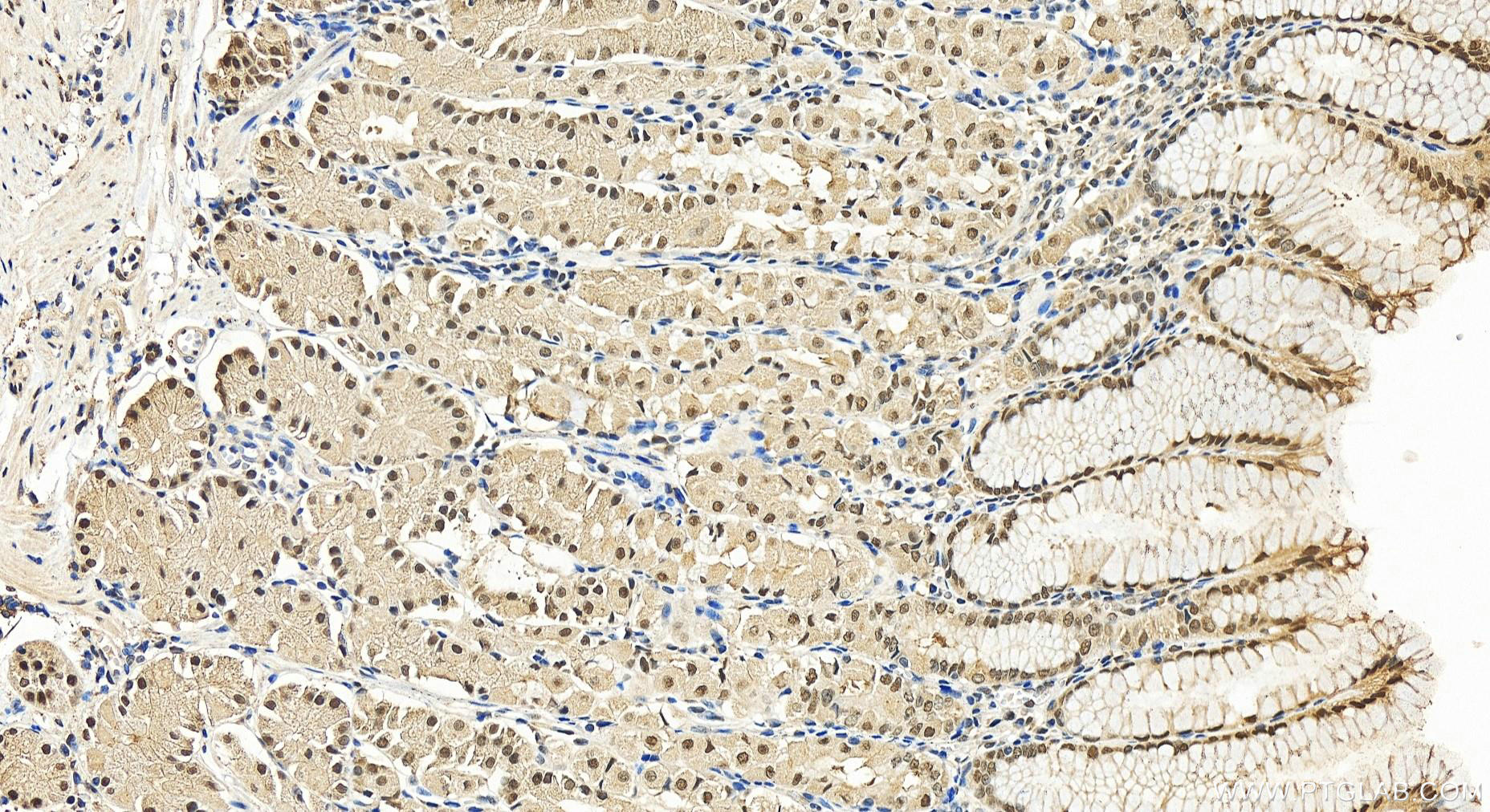 Immunohistochemistry (IHC) staining of human stomach tissue using DDX1 Polyclonal antibody (11357-1-AP)