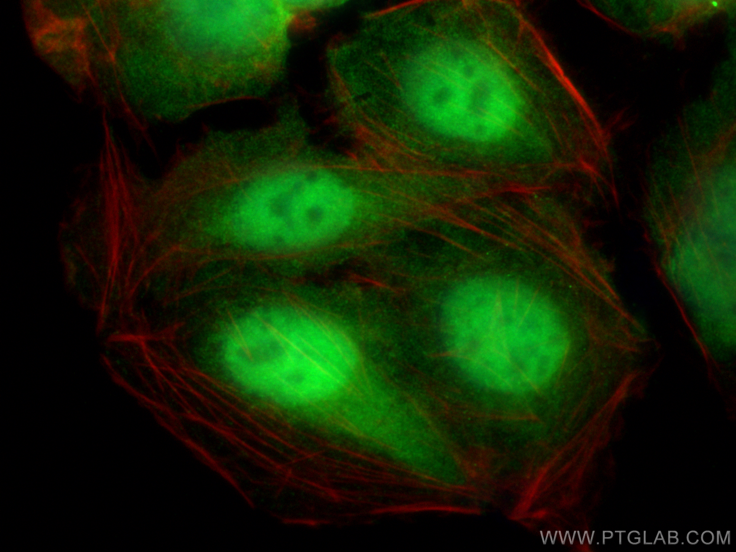 Immunofluorescence (IF) / fluorescent staining of U2OS cells using DDX1 Polyclonal antibody (11357-1-AP)