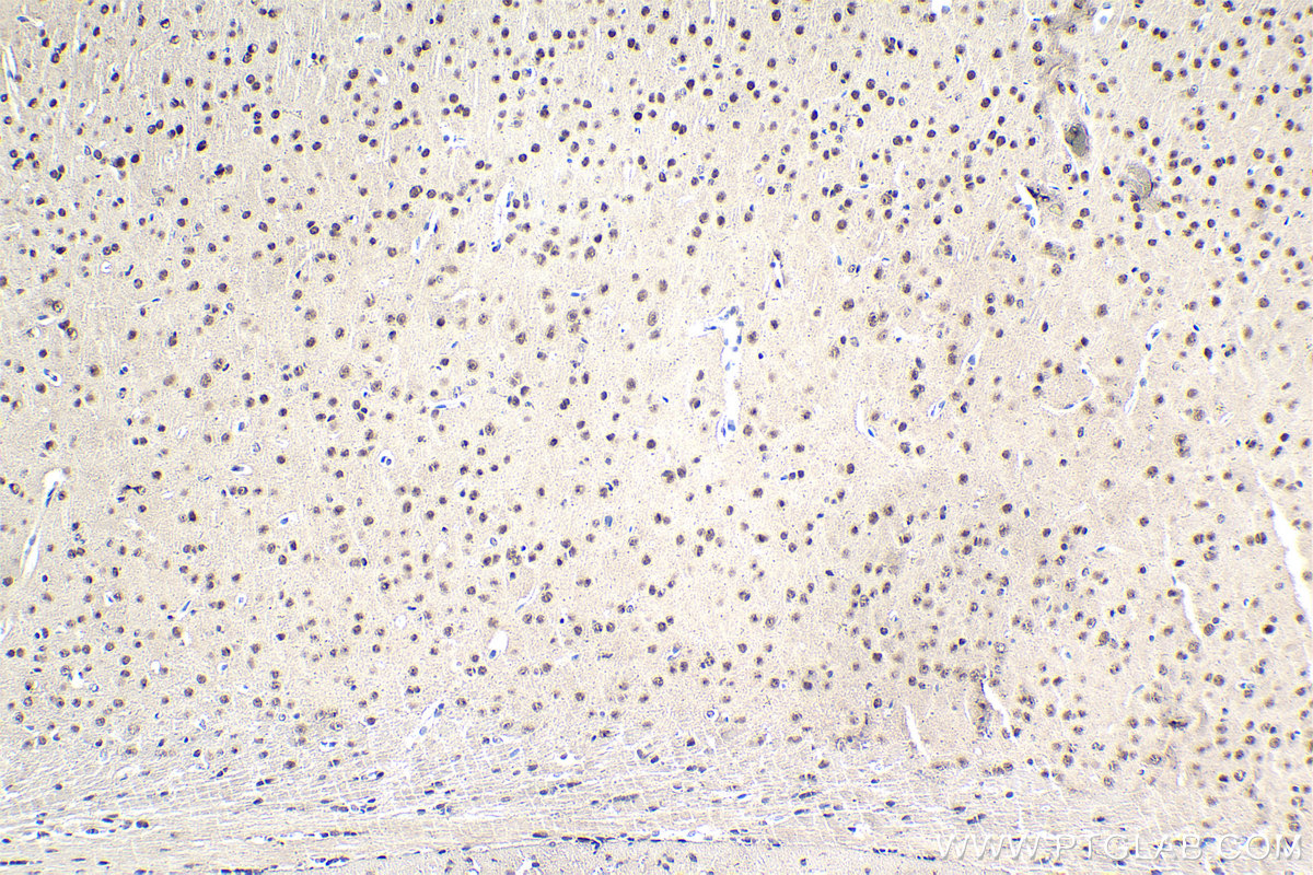 Immunohistochemistry (IHC) staining of mouse brain tissue using DDX1 Monoclonal antibody (67991-1-Ig)