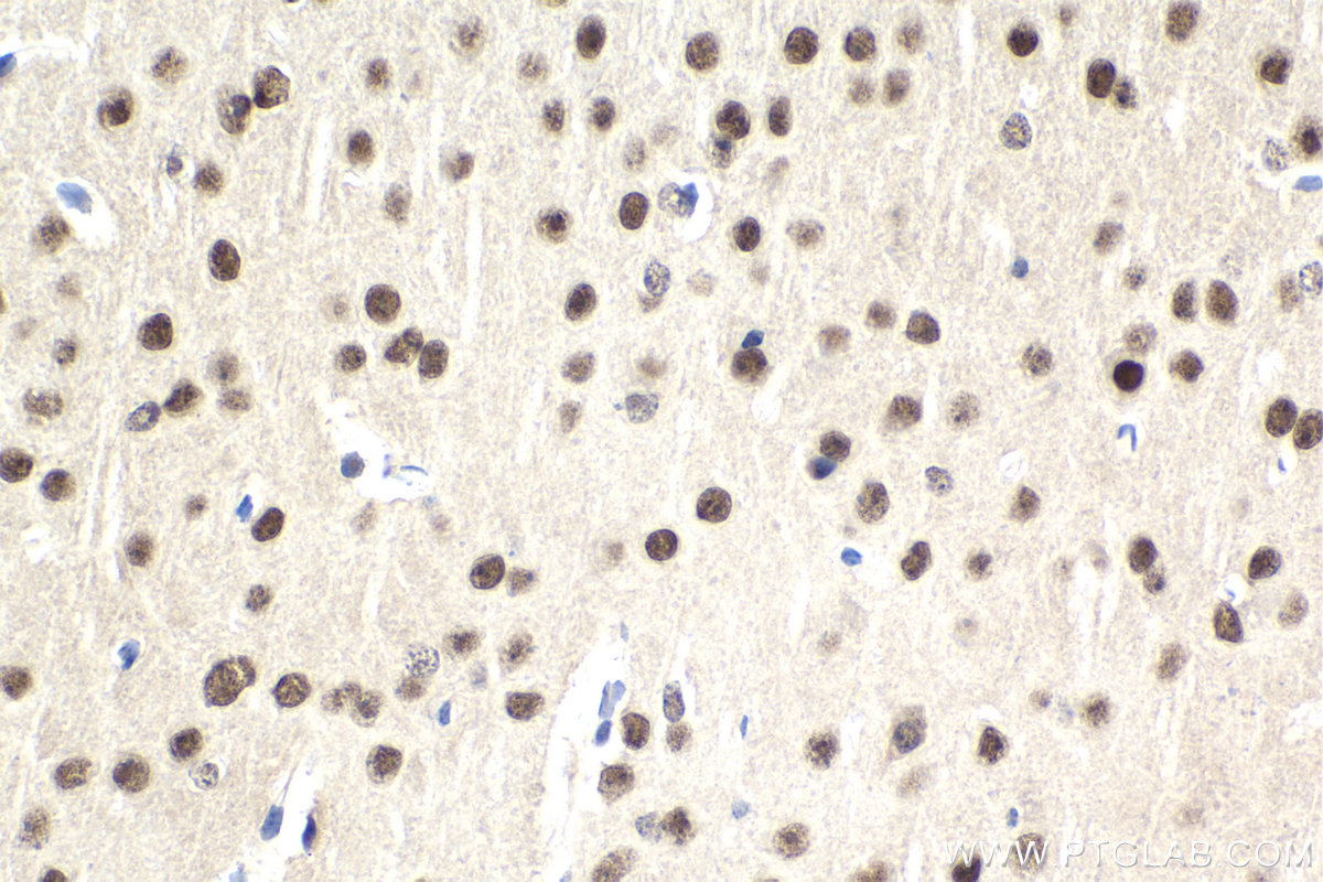 Immunohistochemistry (IHC) staining of mouse brain tissue using DDX1 Monoclonal antibody (67991-1-Ig)