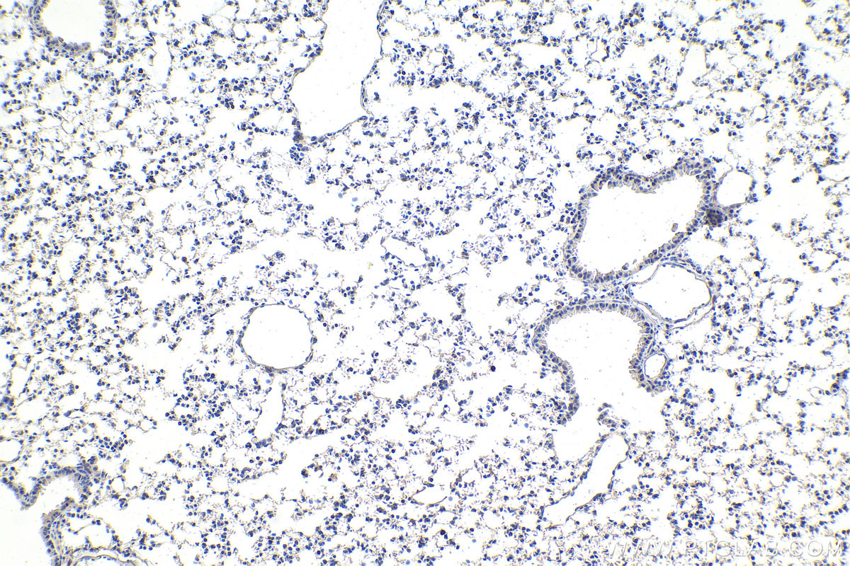 Immunohistochemistry (IHC) staining of mouse lung tissue using DDX1 Monoclonal antibody (67991-1-Ig)