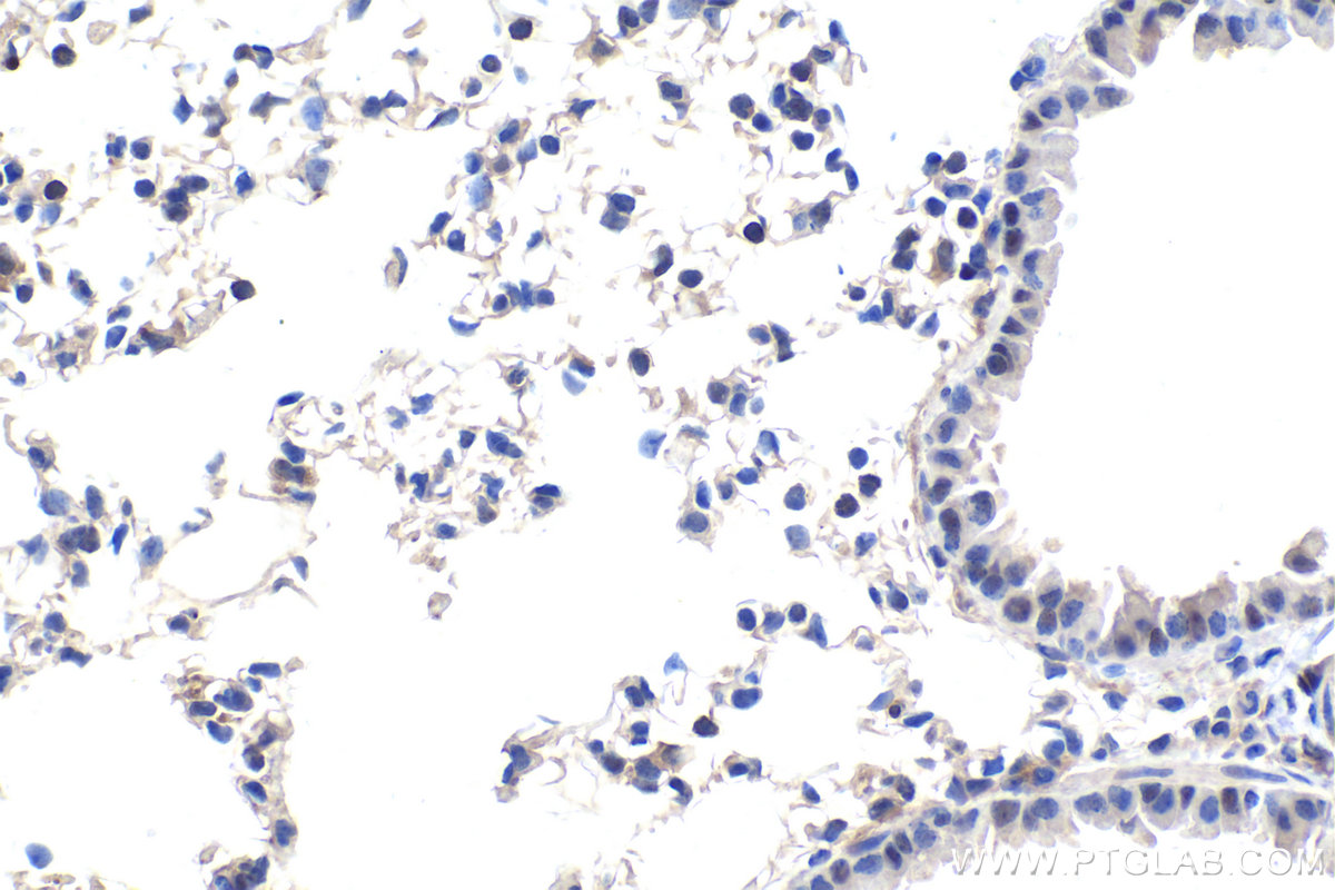 Immunohistochemistry (IHC) staining of mouse lung tissue using DDX1 Monoclonal antibody (67991-1-Ig)