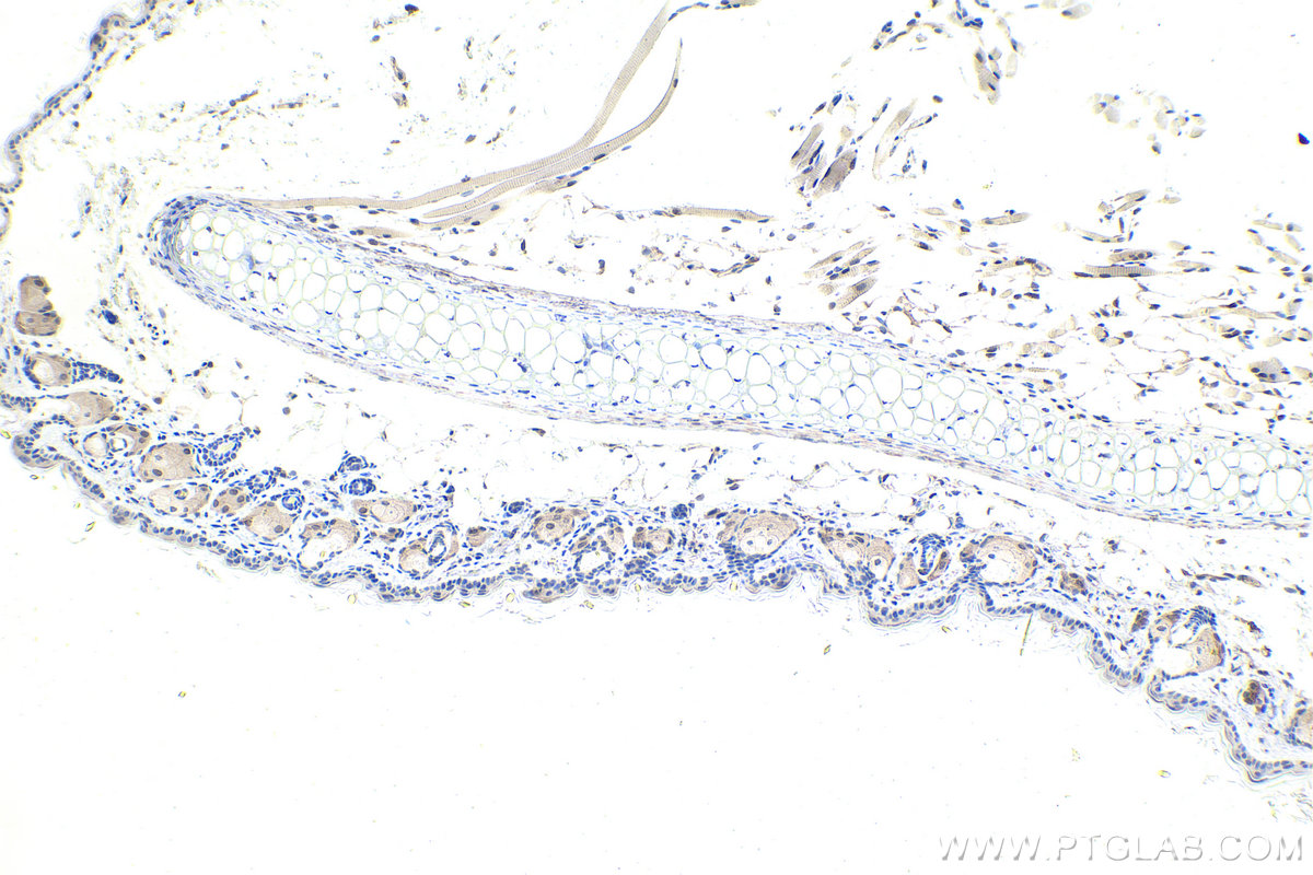 Immunohistochemistry (IHC) staining of mouse skin tissue using DDX1 Monoclonal antibody (67991-1-Ig)