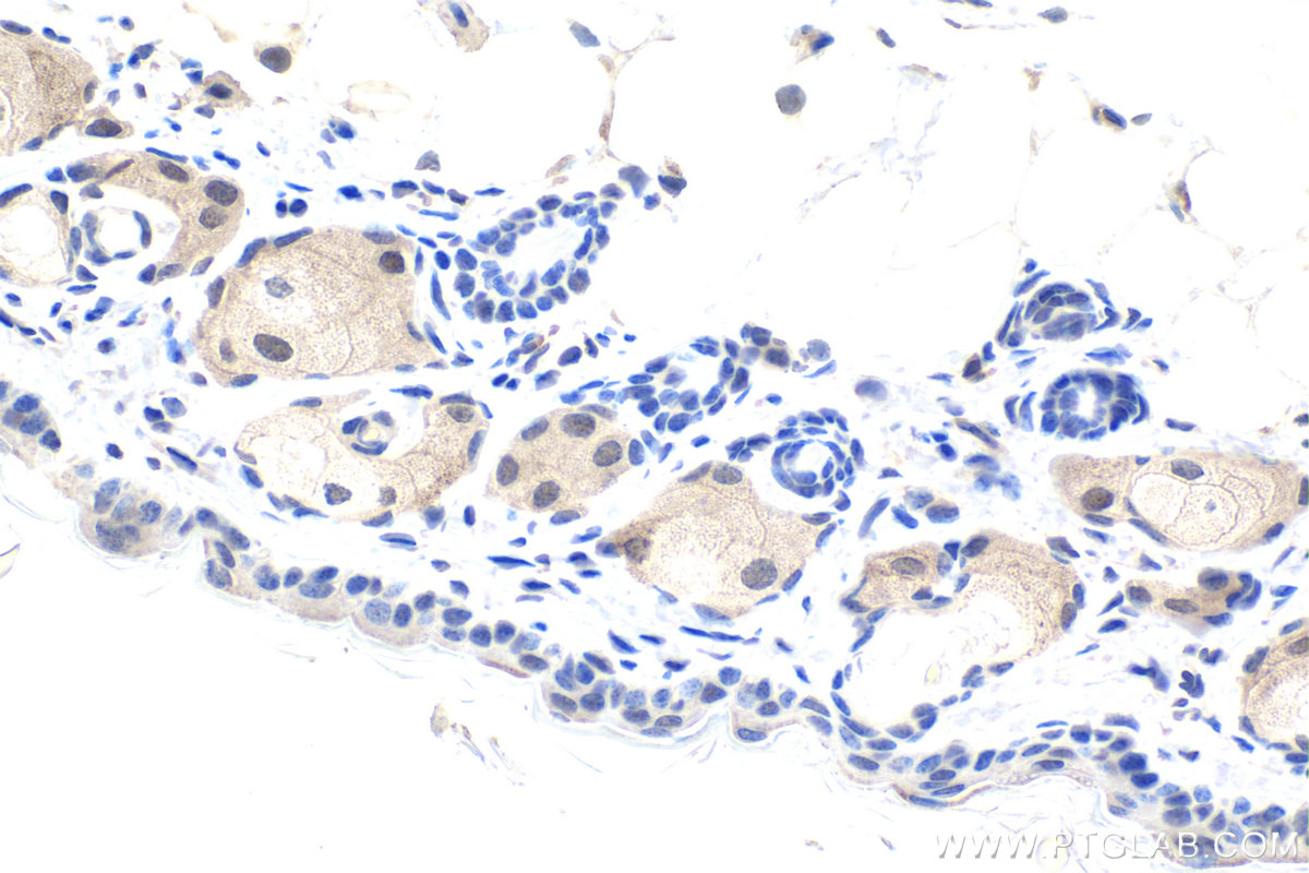 Immunohistochemistry (IHC) staining of mouse skin tissue using DDX1 Monoclonal antibody (67991-1-Ig)